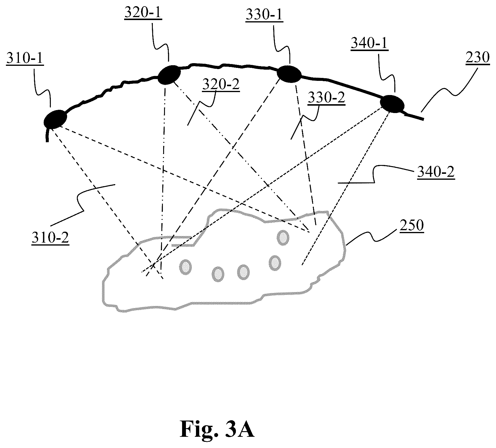 Patent US12496149 Figure 3 – System and method for automated simultaneous trocar and robot base location determination