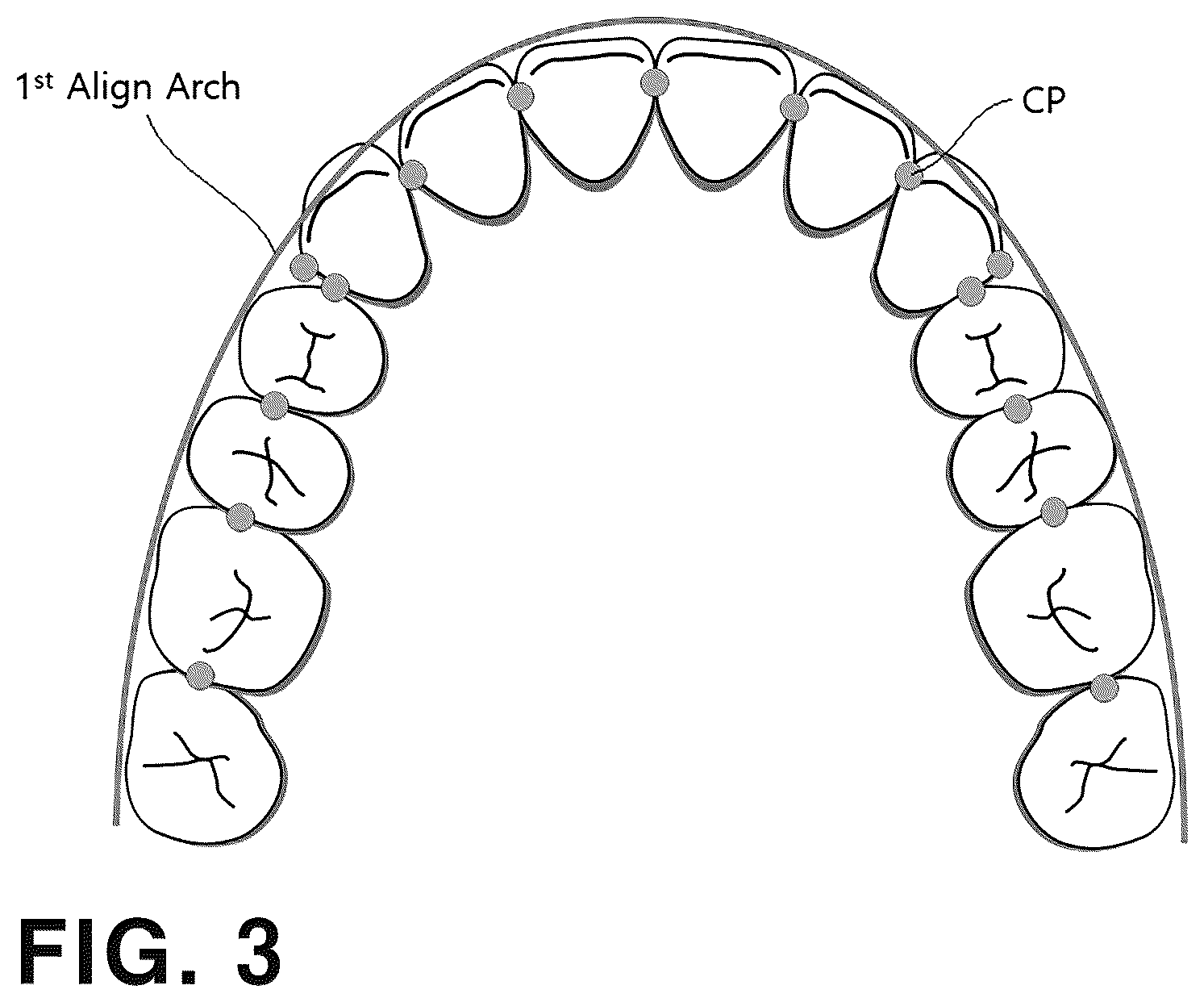 Patent US12496163 Figure 2 – Method and computer program for designing straightening aligners