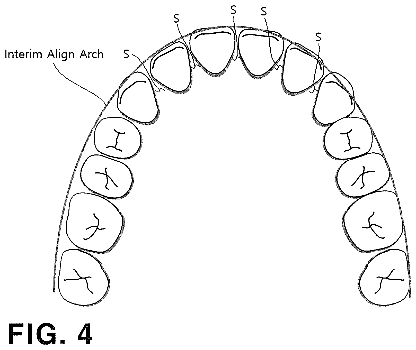 Patent US12496163 Figure 3 – Method and computer program for designing straightening aligners