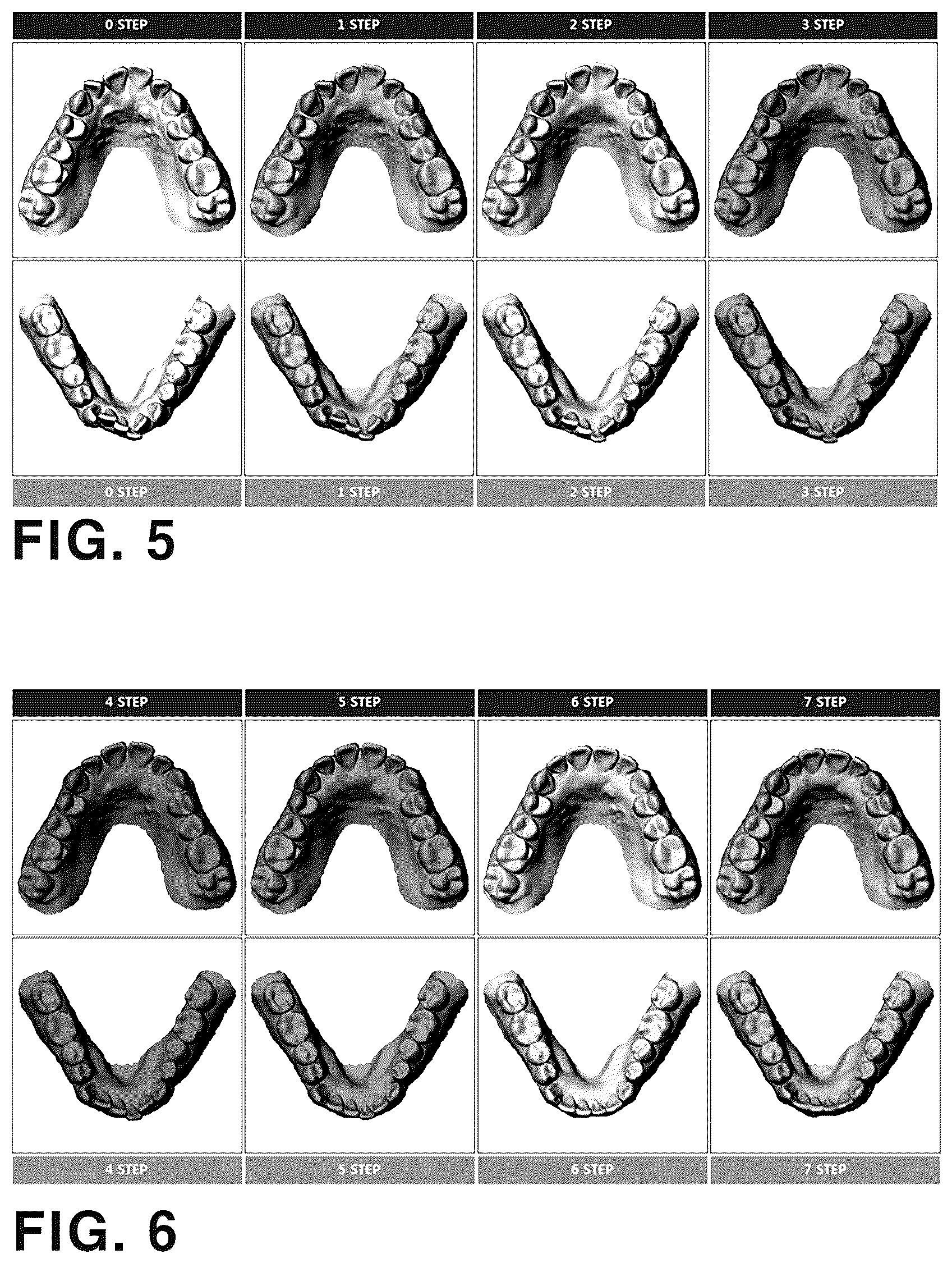 Patent US12496163 Figure 4 – Method and computer program for designing straightening aligners