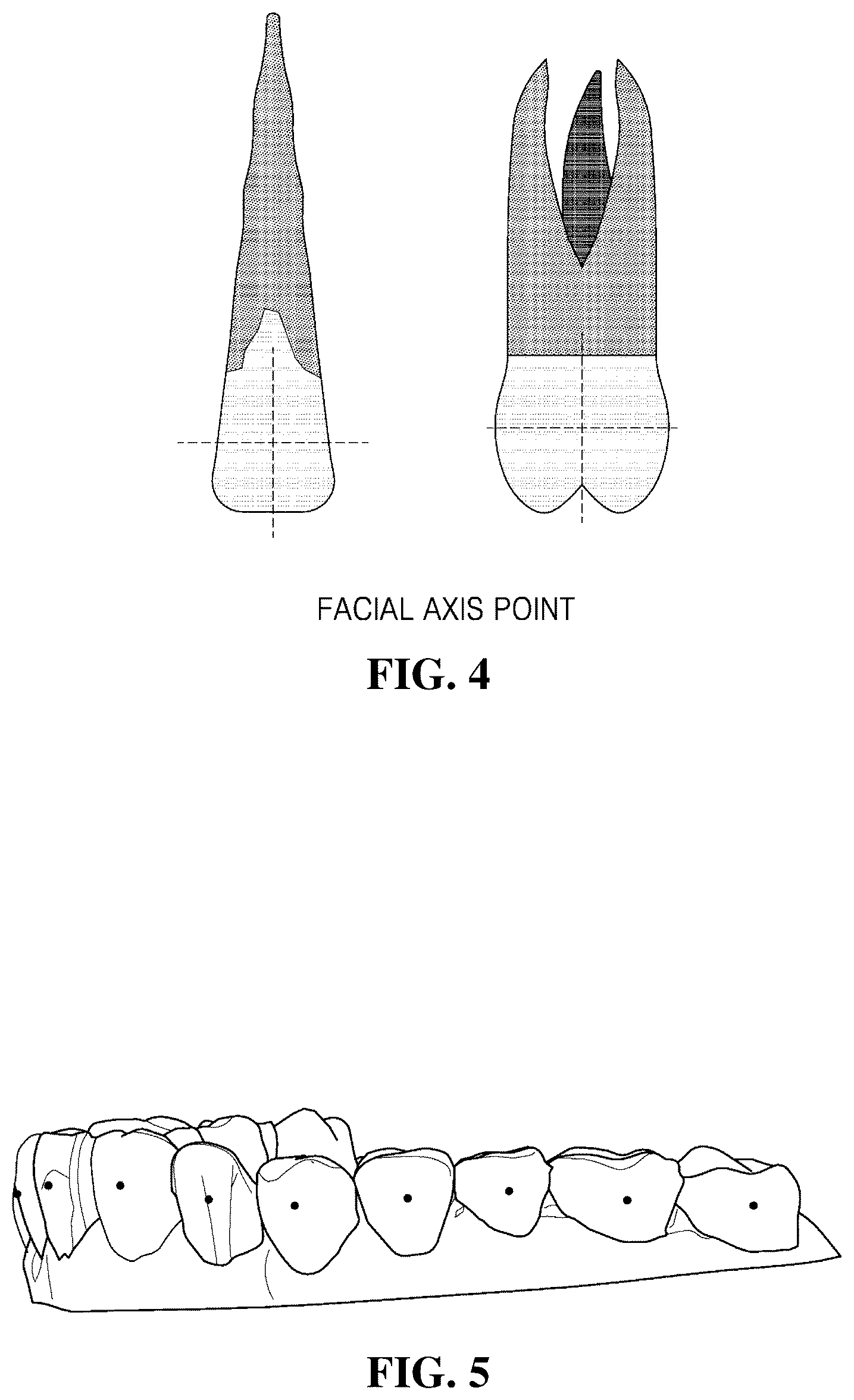Patent US12496164 Figure 4 – Method and device for generating orthodontic teeth alignment shape