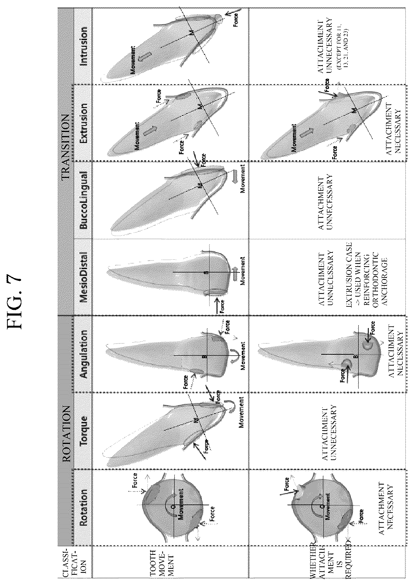Patent US12496165 Figure 7 – Clear alignment attachment design method and clear aligners