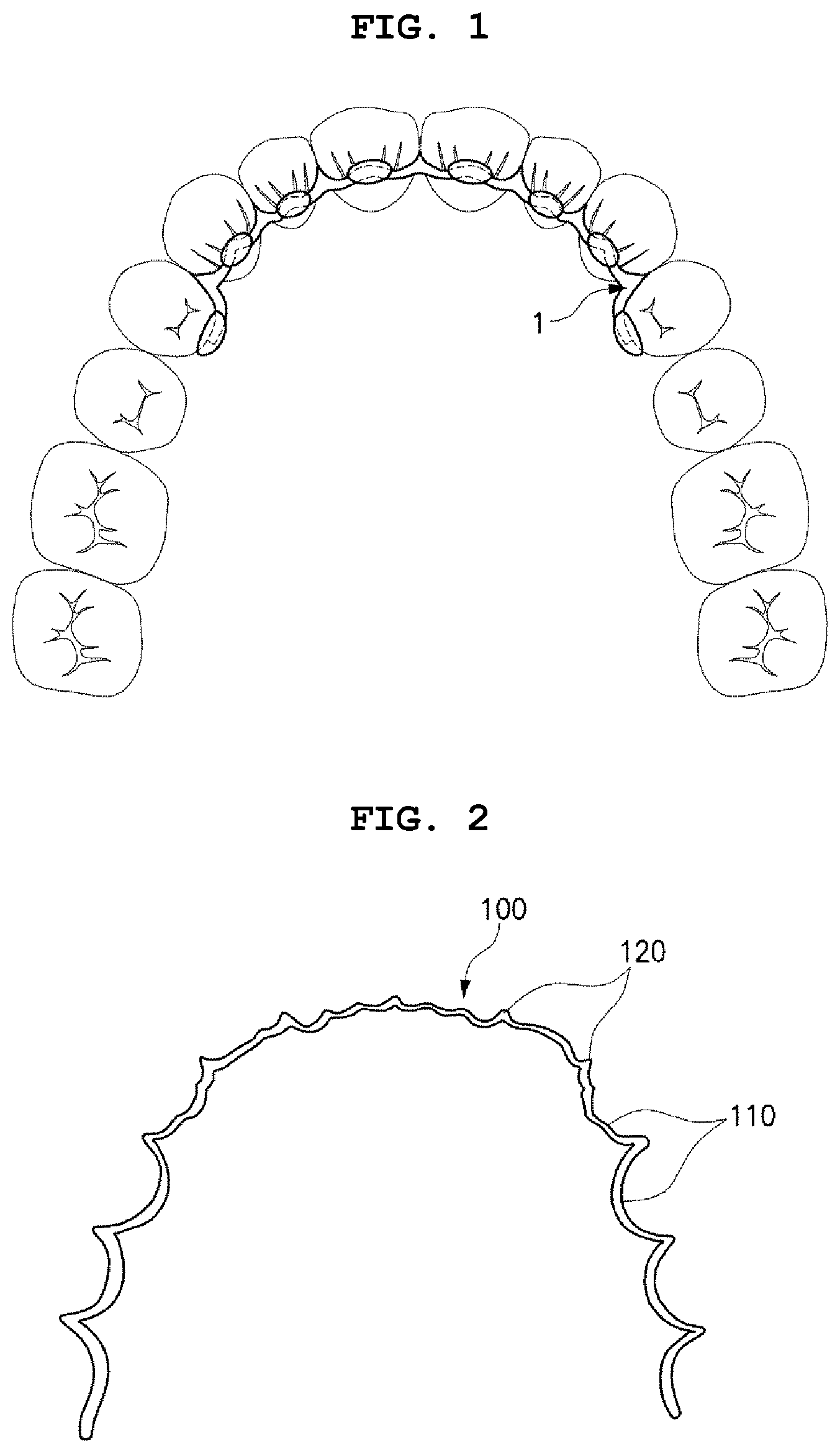 Patent US12496167 Figure 1 – Adhesive retainer and manufacturing method therefor