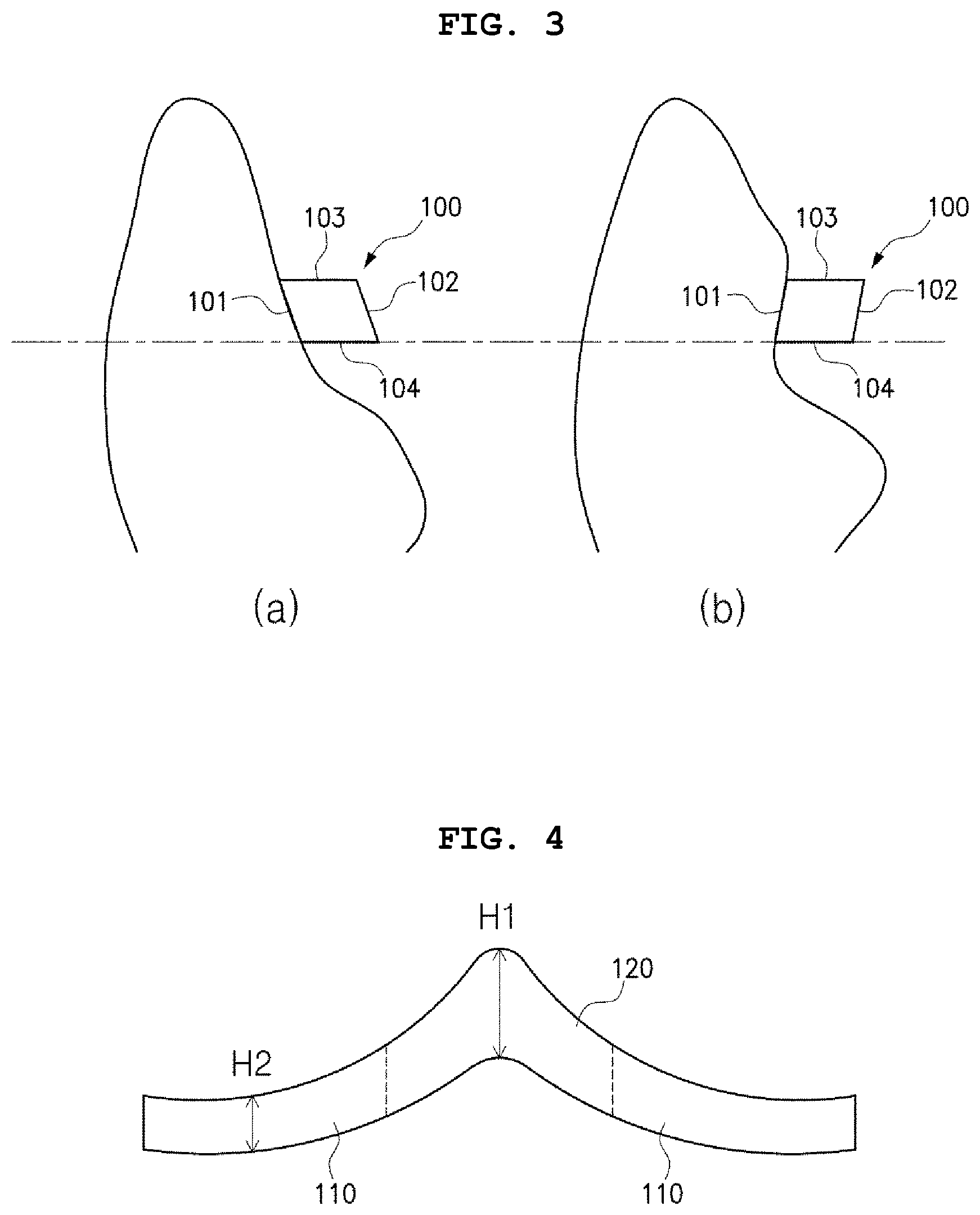 Patent US12496167 Figure 2 – Adhesive retainer and manufacturing method therefor