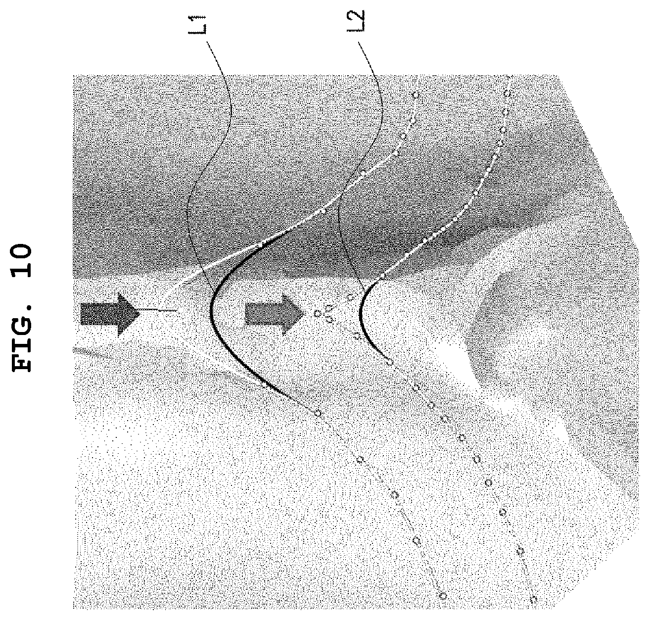 Patent US12496167 Figure 8 – Adhesive retainer and manufacturing method therefor