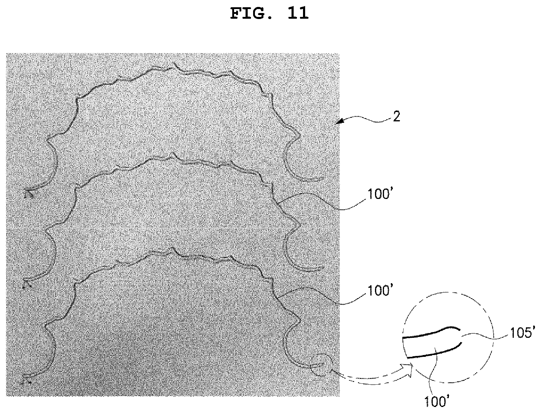 Patent US12496167 Figure 9 – Adhesive retainer and manufacturing method therefor