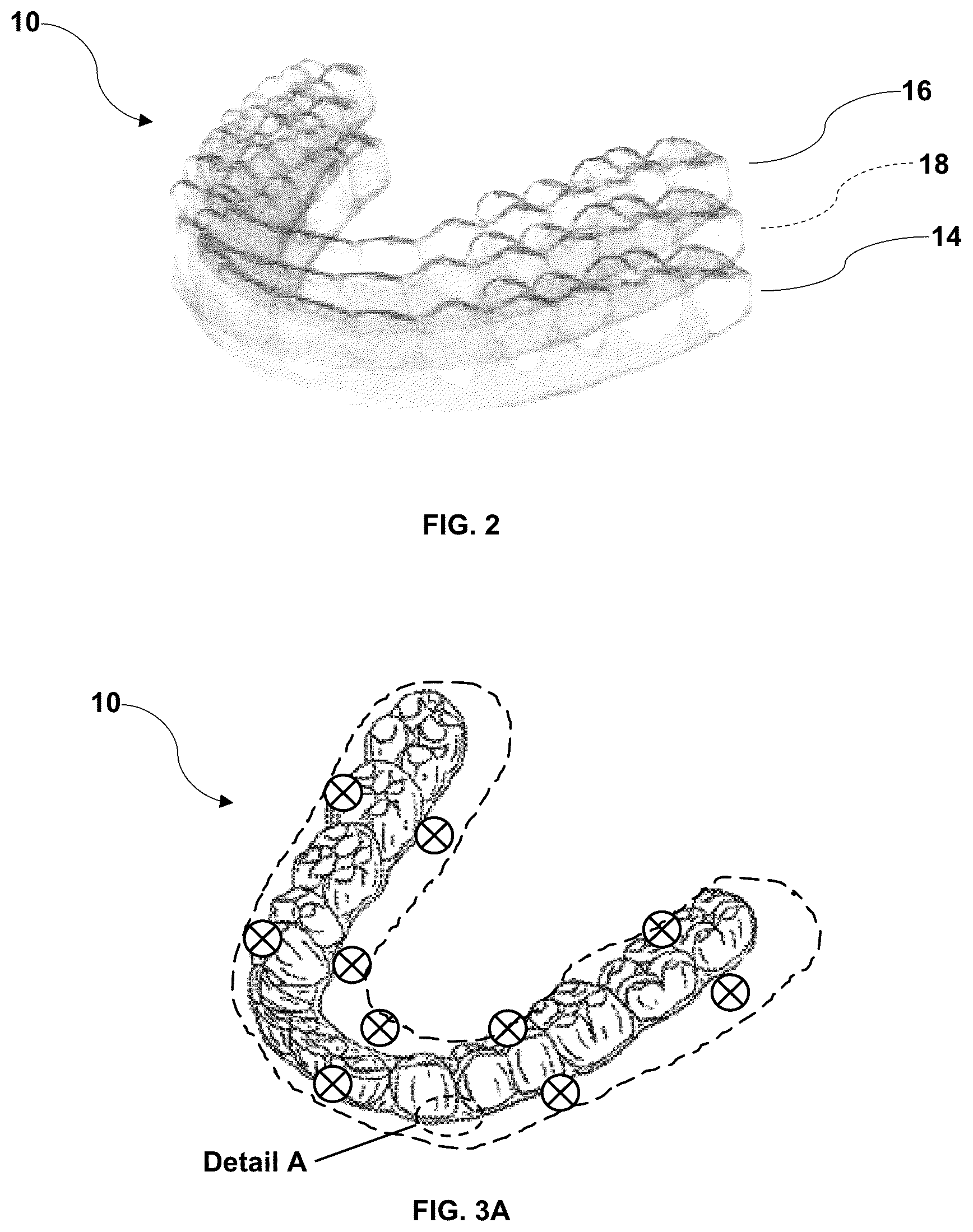 Patent US12496168 Figure 2 – Elastic orthodontic appliances, systems, and methods for use