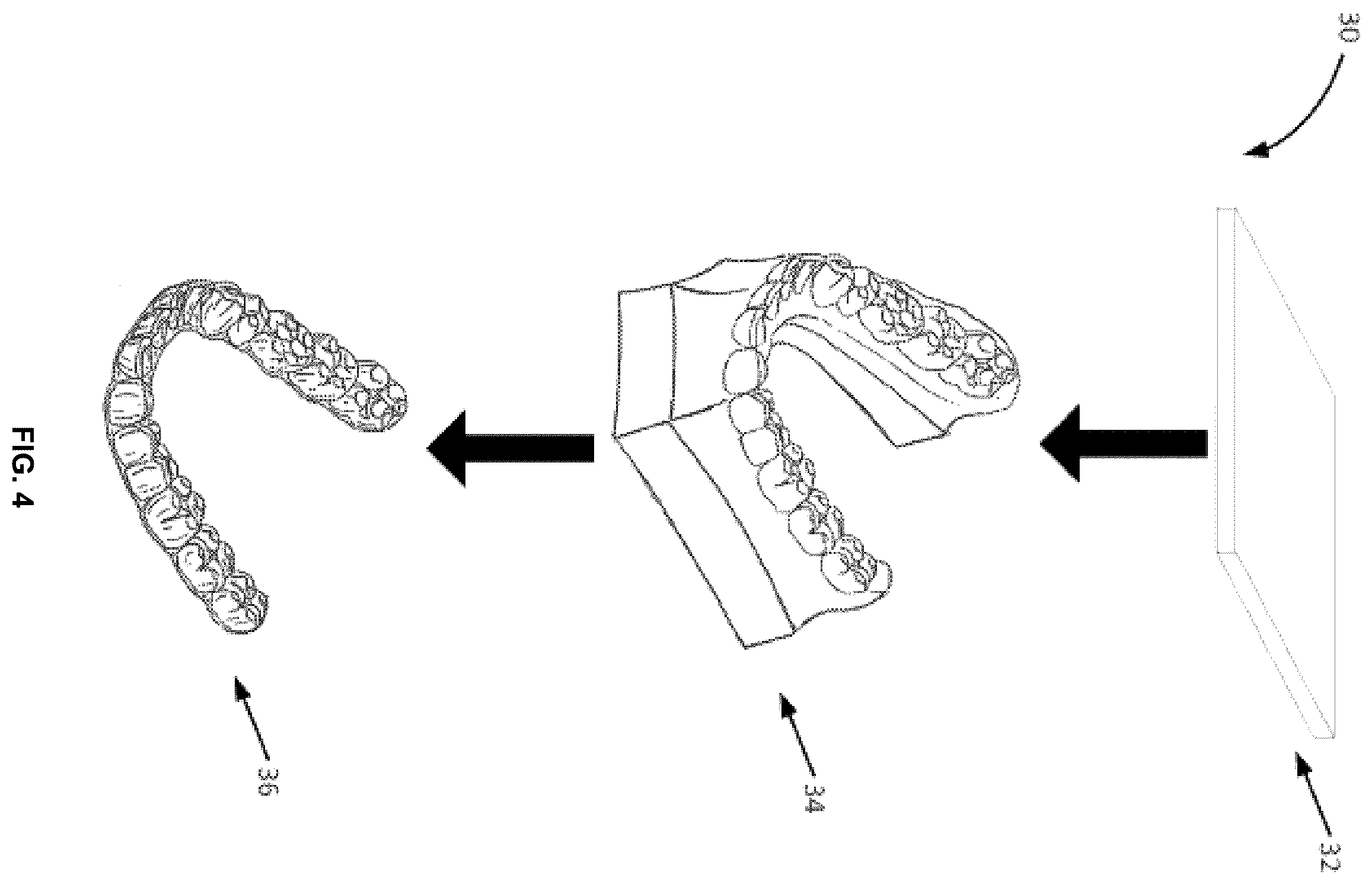 Patent US12496168 Figure 4 – Elastic orthodontic appliances, systems, and methods for use