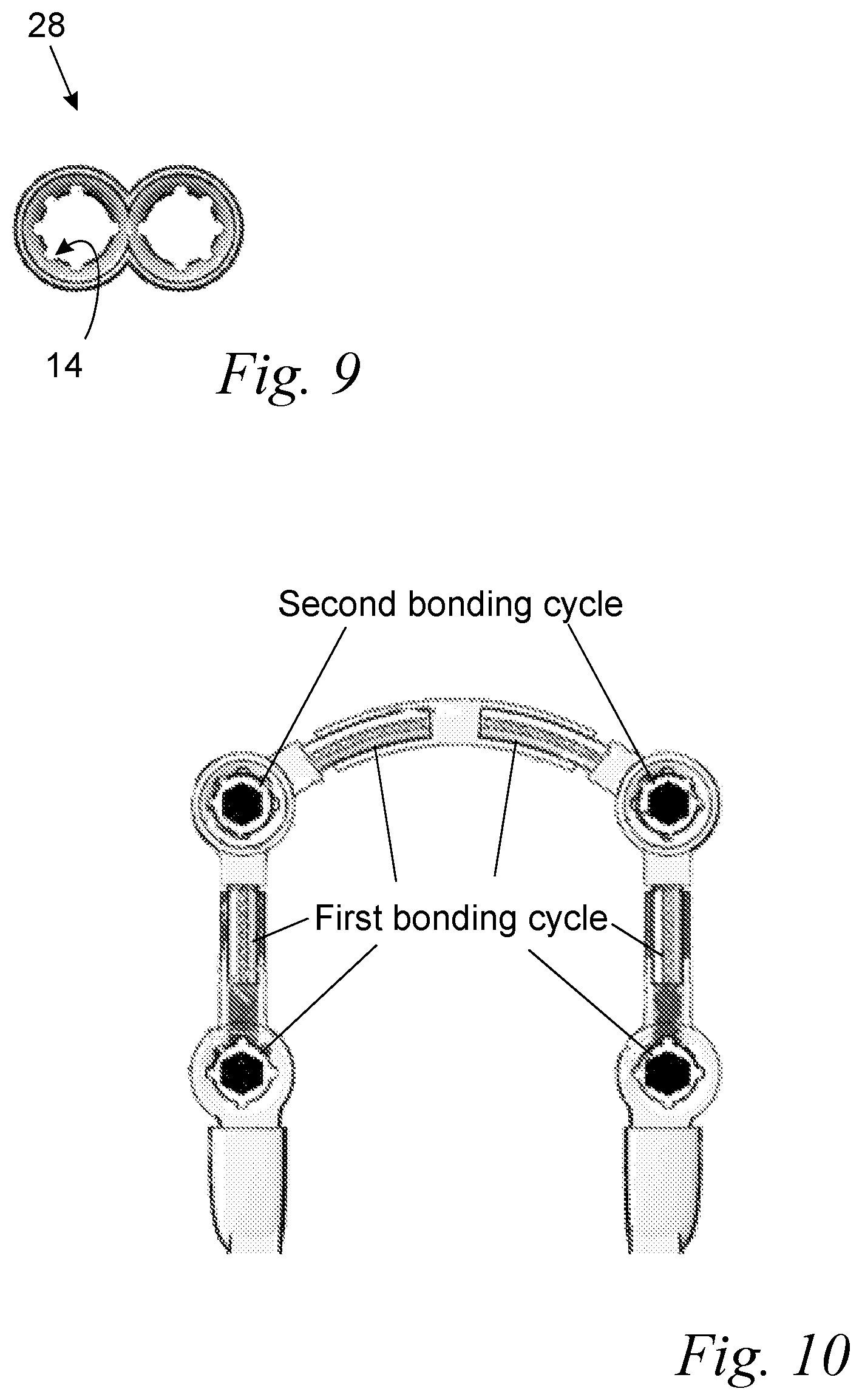 Patent US12496170 Figure 3 – Dental bar