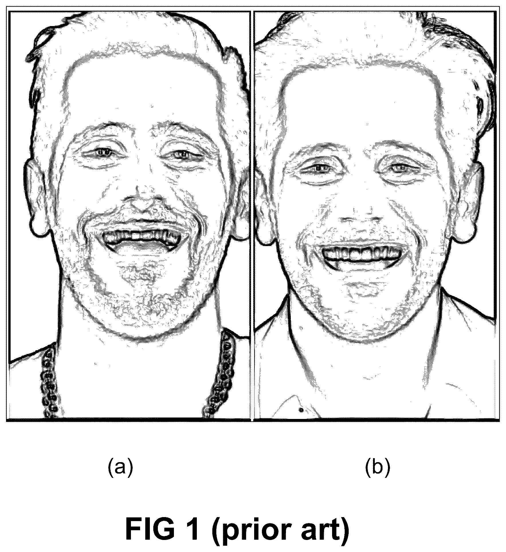 Patent US12496172 Figure 1 – Computer implemented methods for dental design