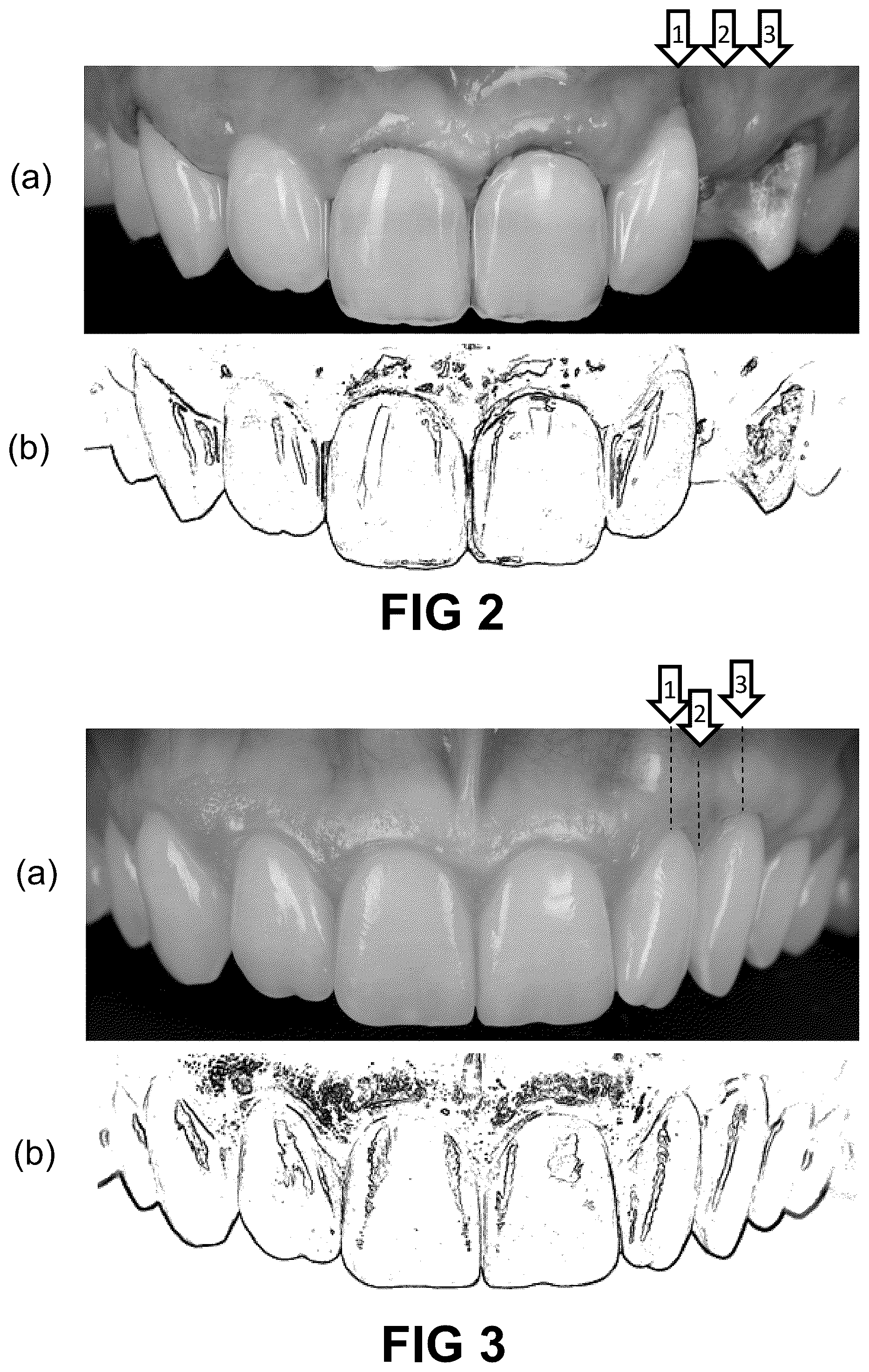 Patent US12496172 Figure 2 – Computer implemented methods for dental design
