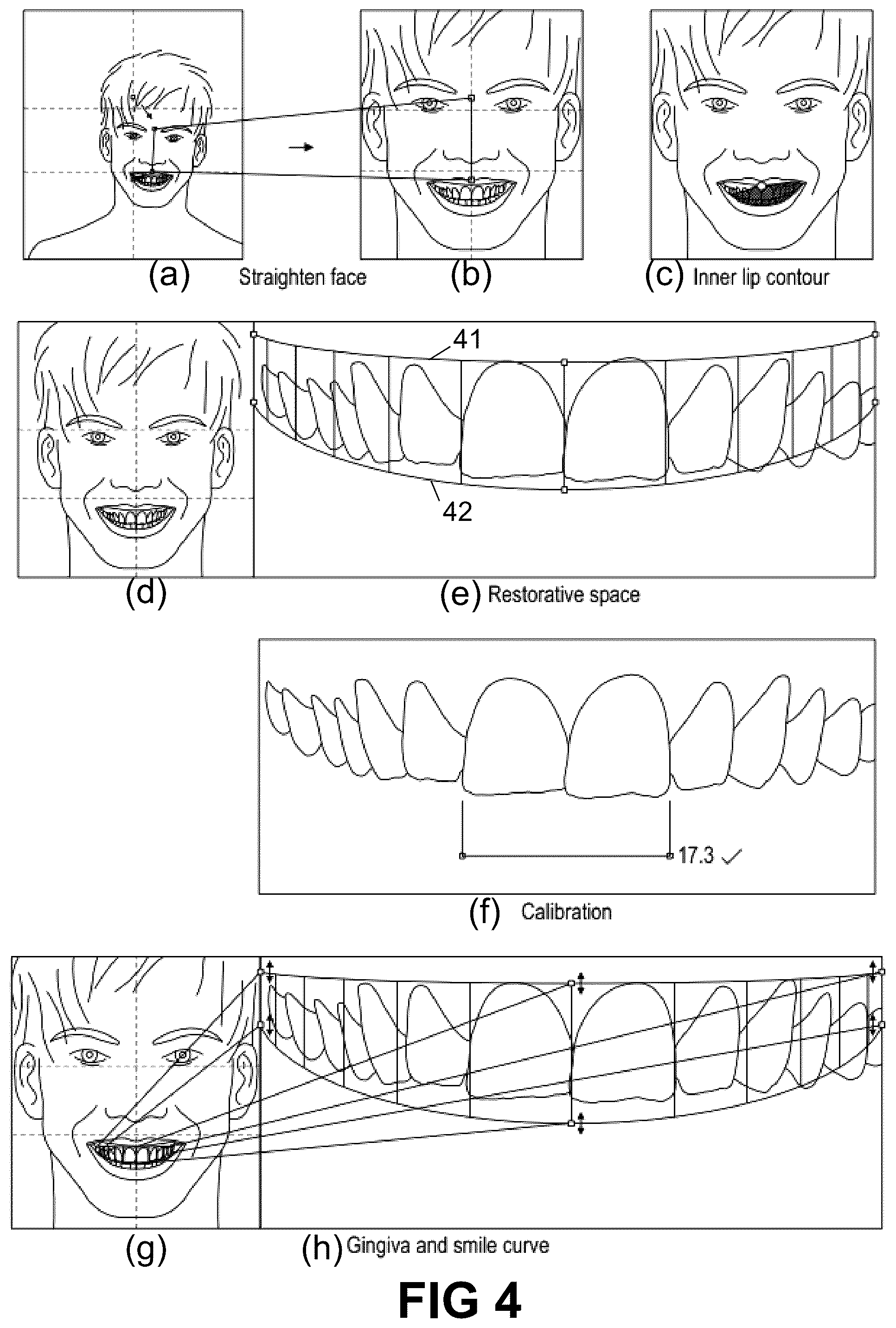 Patent US12496172 Figure 3 – Computer implemented methods for dental design