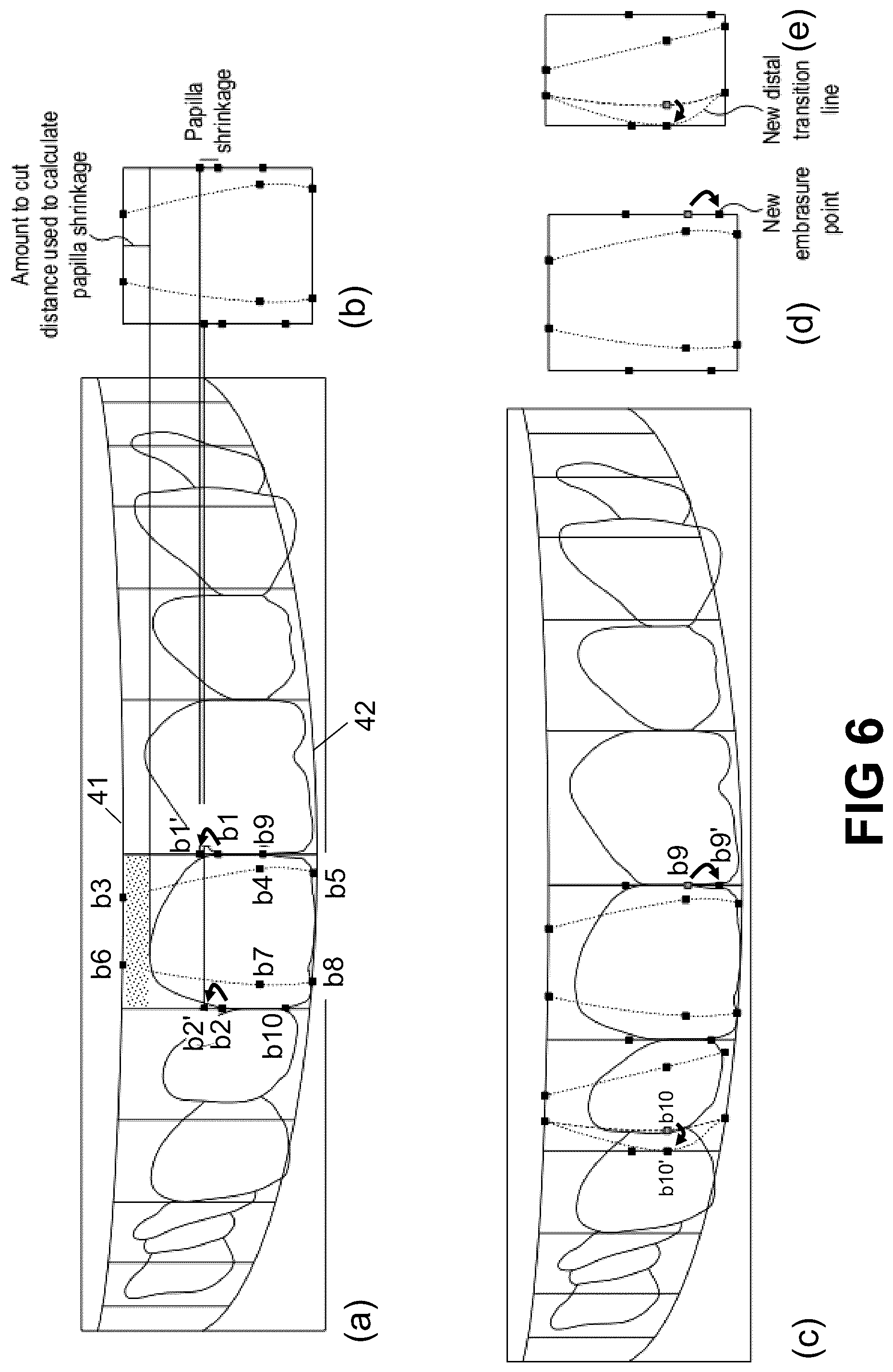 Patent US12496172 Figure 5 – Computer implemented methods for dental design