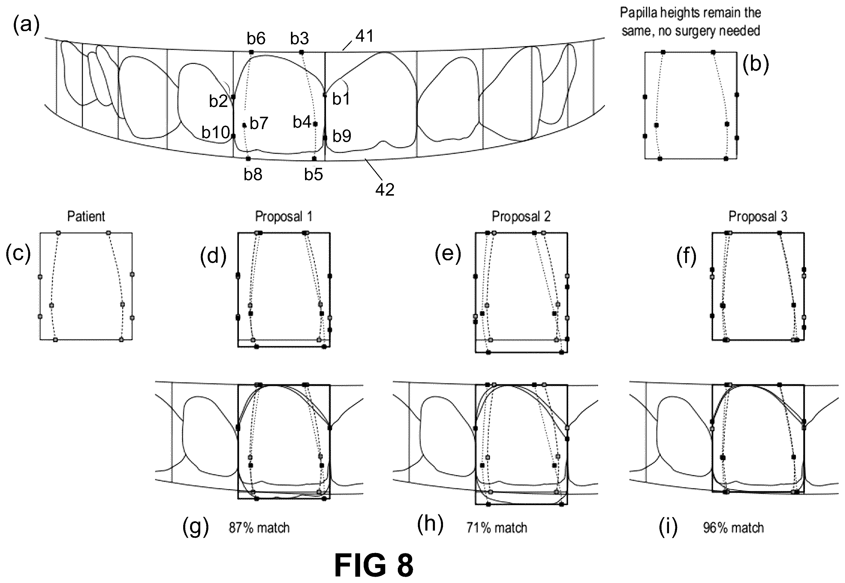 Patent US12496172 Figure 7 – Computer implemented methods for dental design