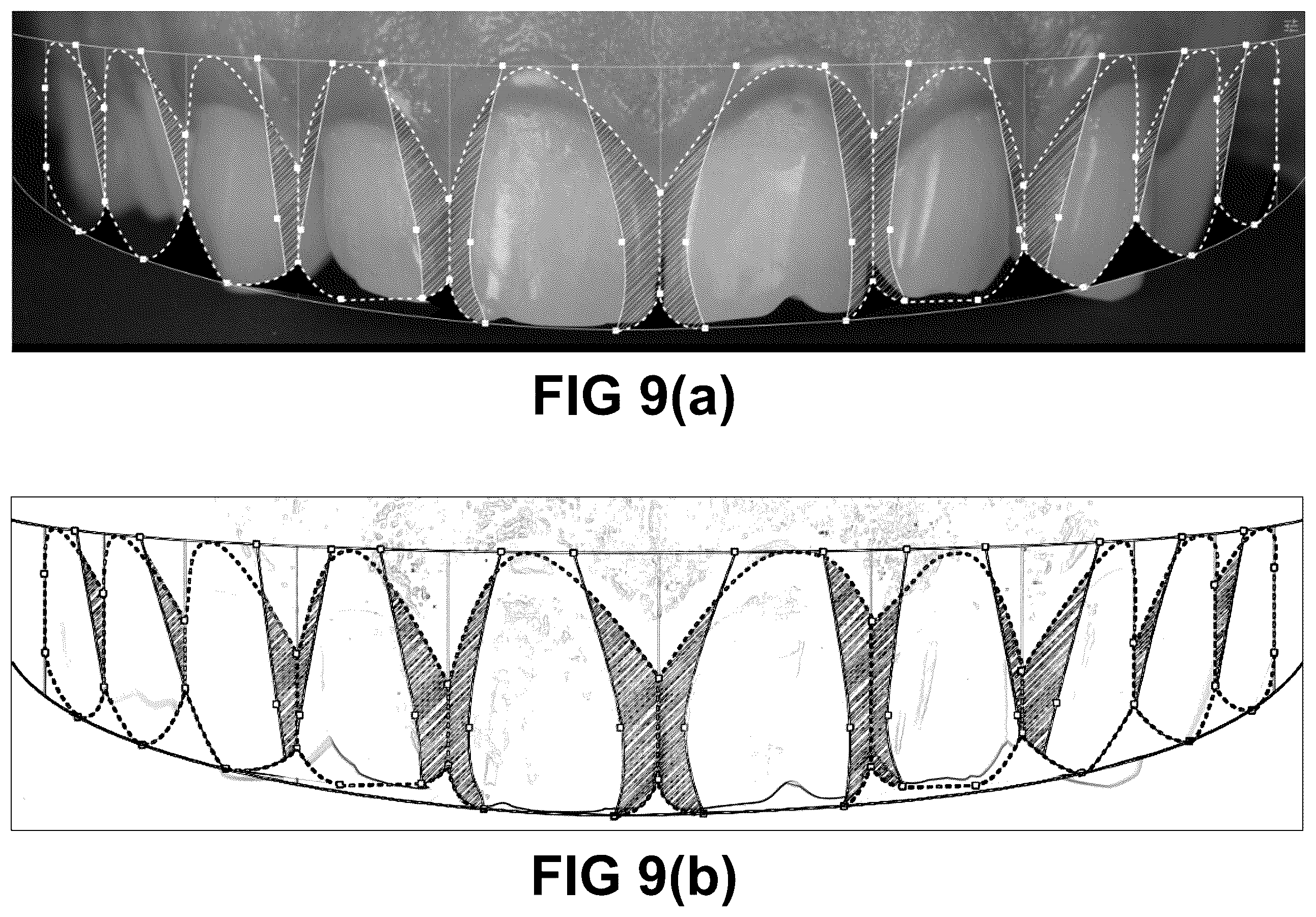 Patent US12496172 Figure 8 – Computer implemented methods for dental design