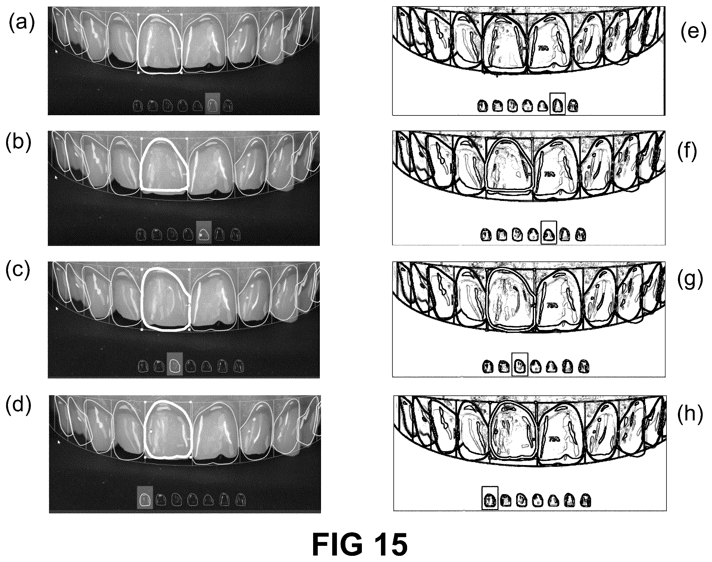 Patent US12496172 Figure 14 – Computer implemented methods for dental design