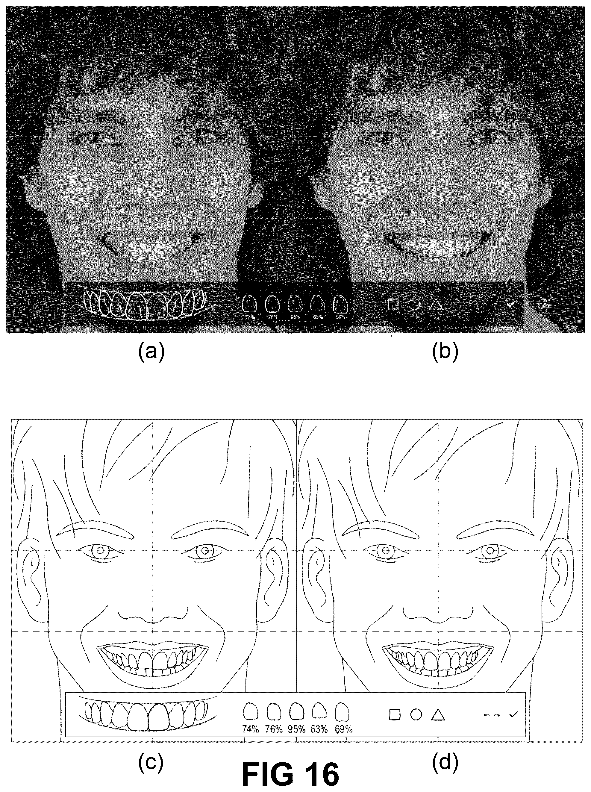 Patent US12496172 Figure 15 – Computer implemented methods for dental design