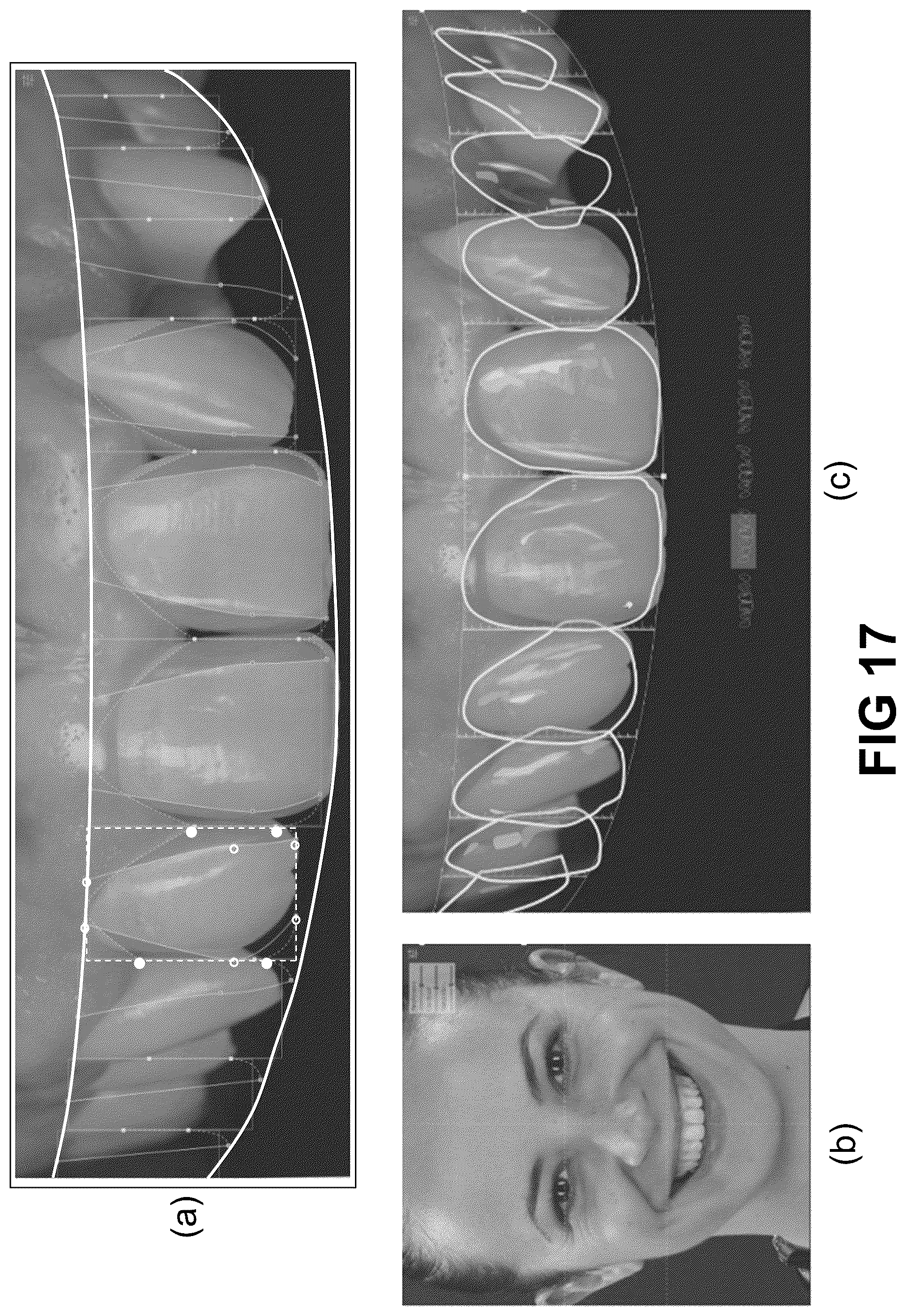 Patent US12496172 Figure 16 – Computer implemented methods for dental design
