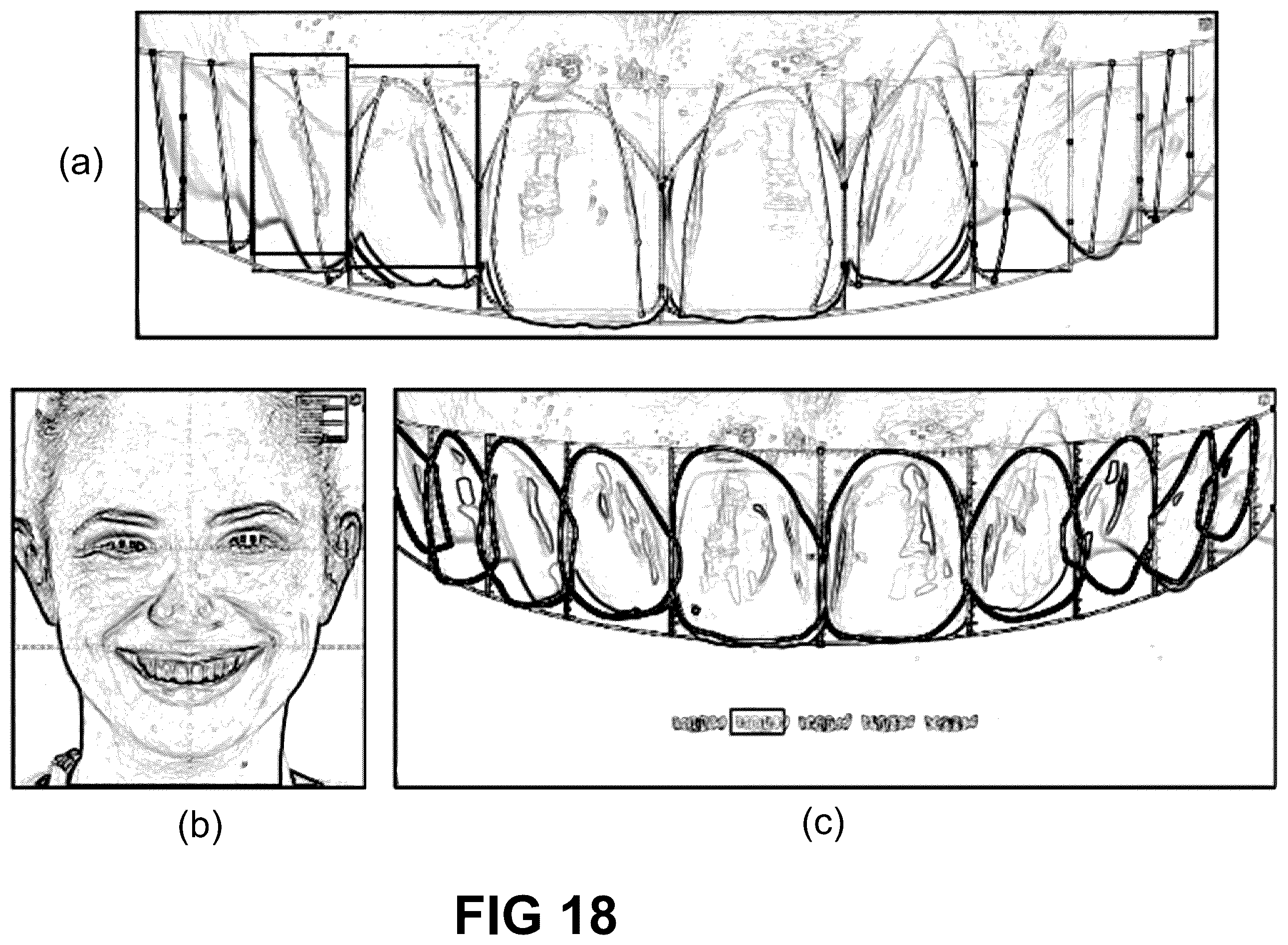 Patent US12496172 Figure 17 – Computer implemented methods for dental design