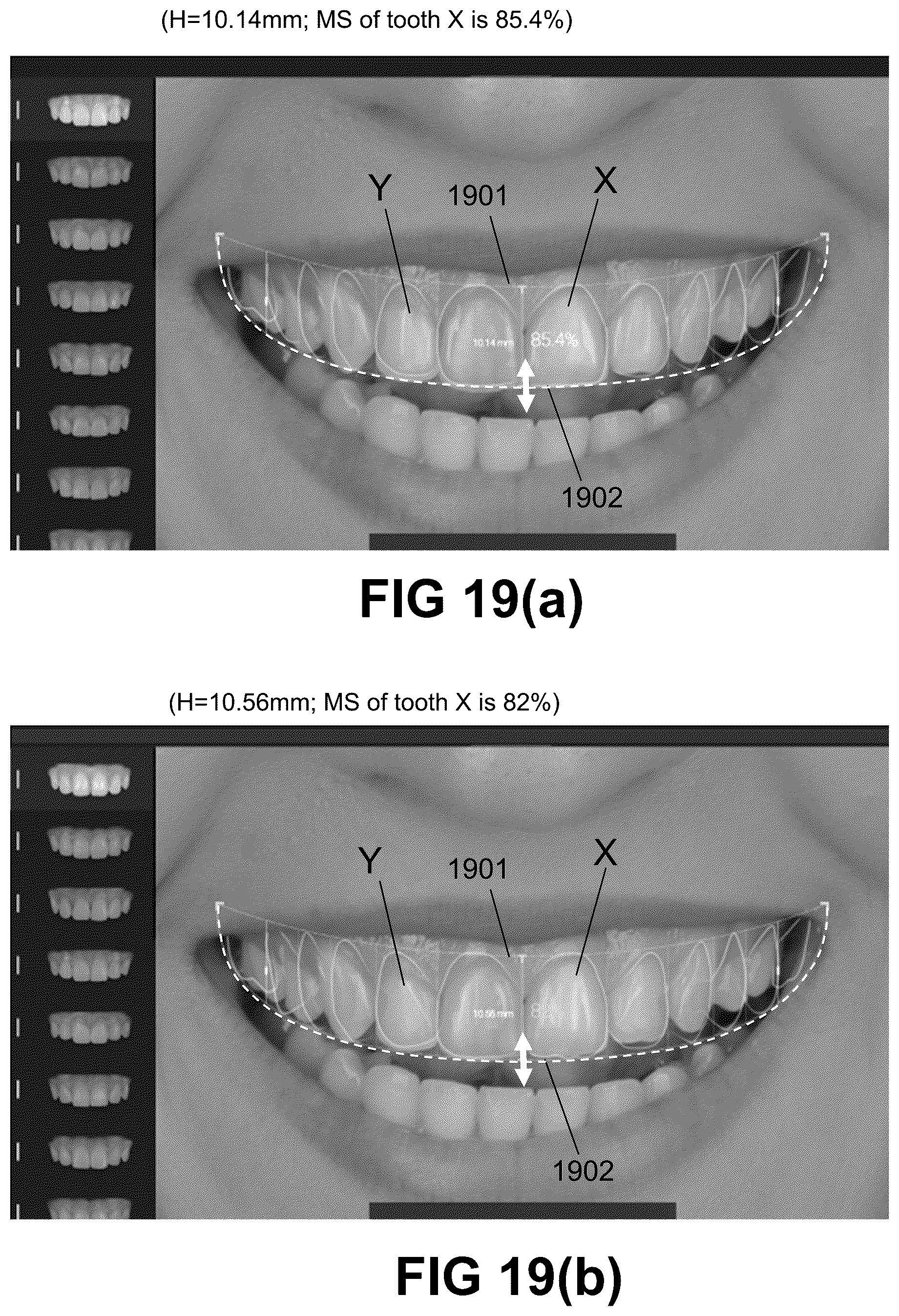 Patent US12496172 Figure 18 – Computer implemented methods for dental design
