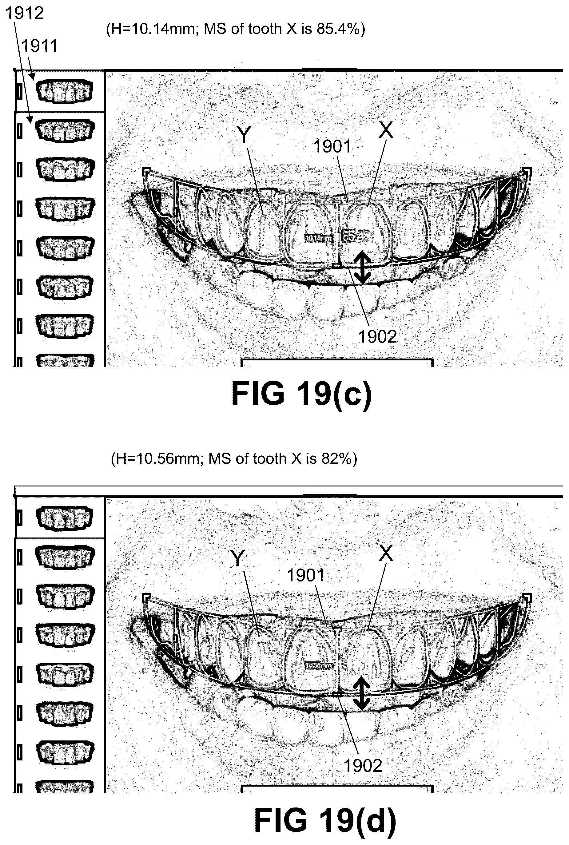 Patent US12496172 Figure 19 – Computer implemented methods for dental design