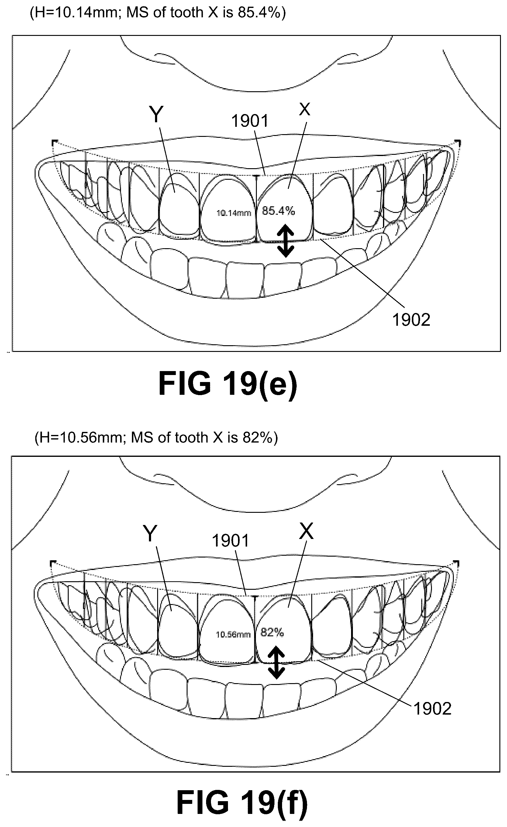 Patent US12496172 Figure 20 – Computer implemented methods for dental design