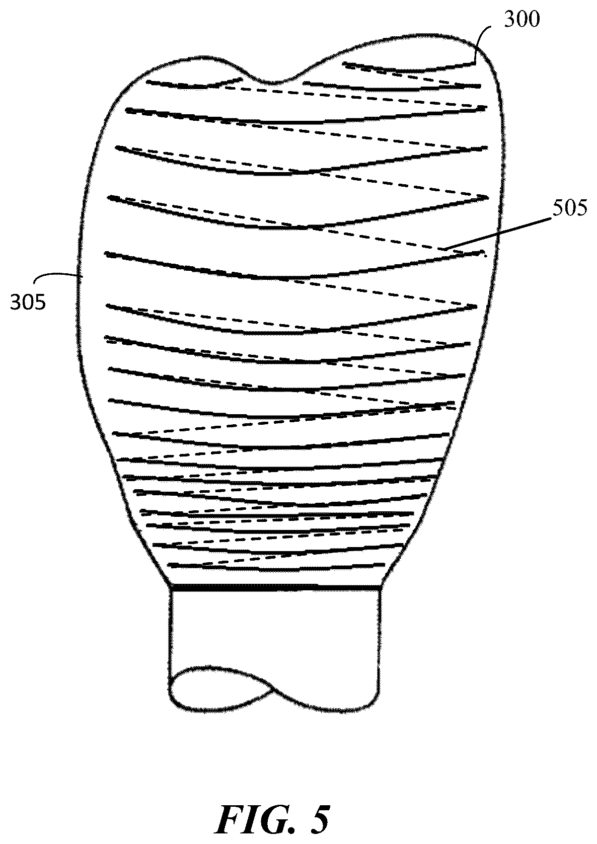 Patent US12496173 Figure 5 – Method for coloring a dental prosthesis