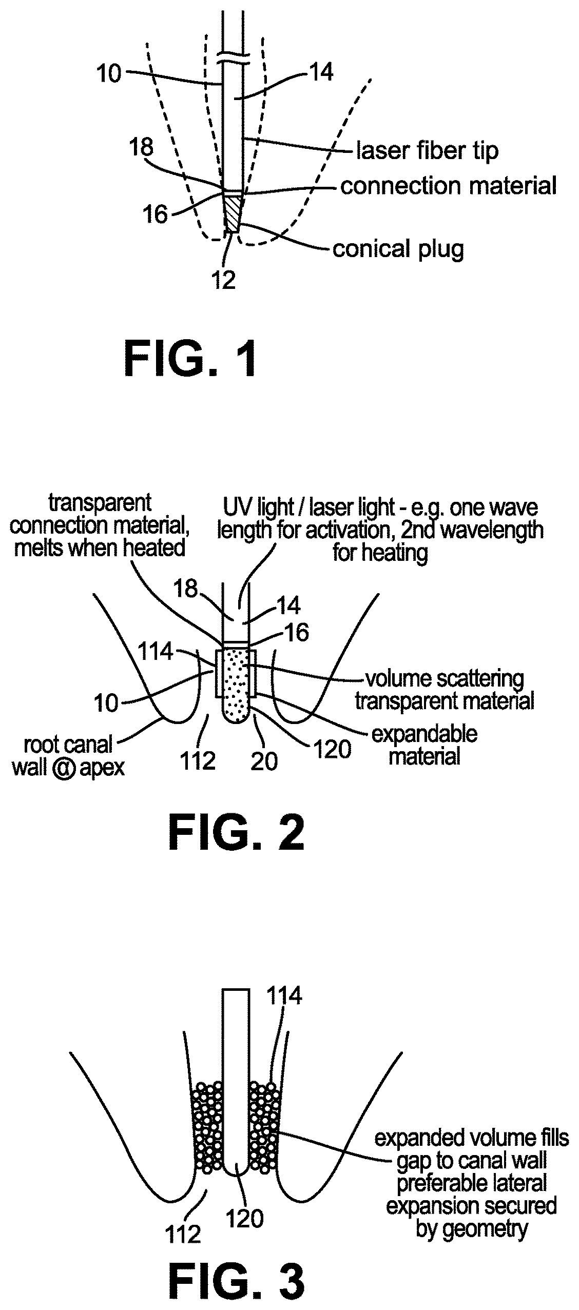 Patent US12496175 Figure 1 – Method and arrangement for cleaning of a canal