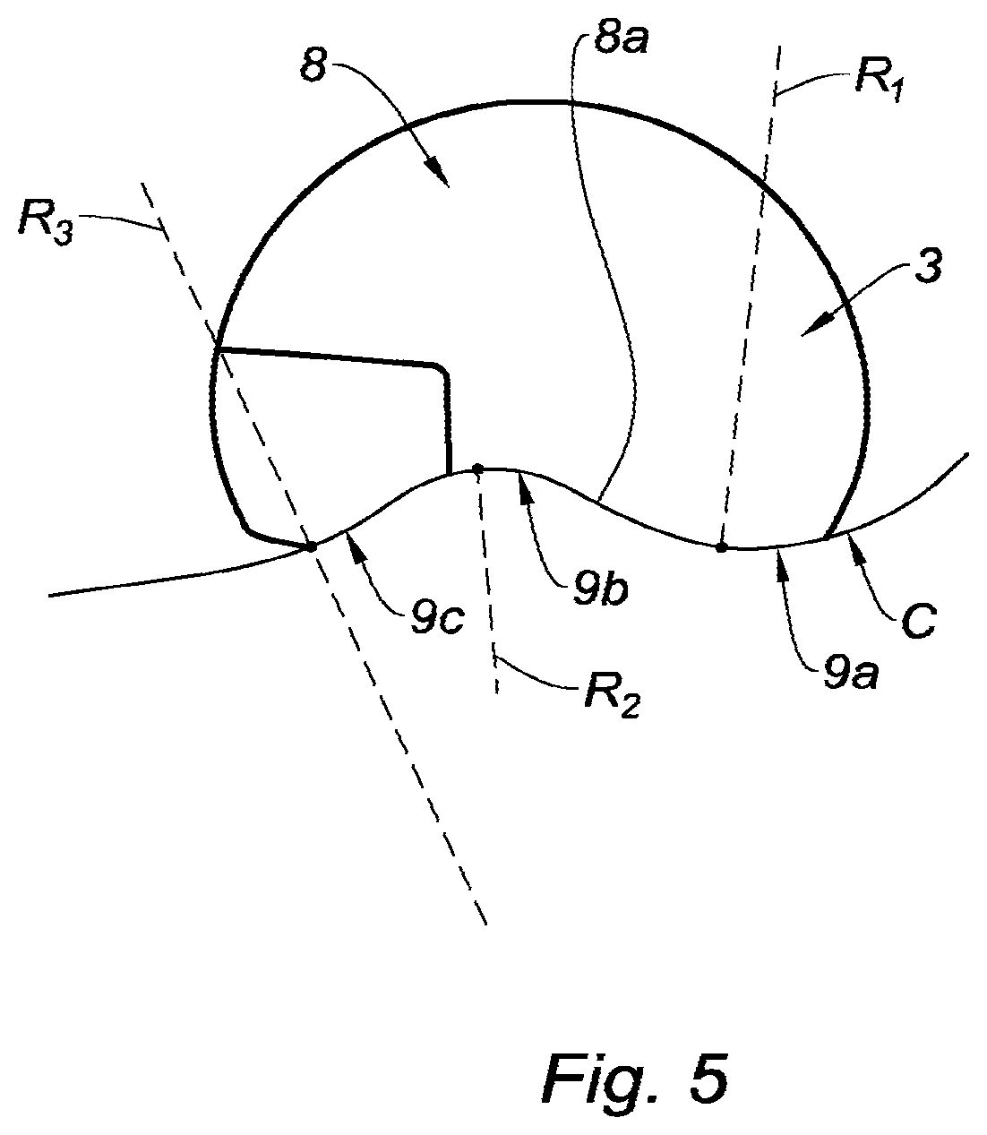 Patent US12496178 Figure 4 – Prosthesis for inguinal hernia repair
