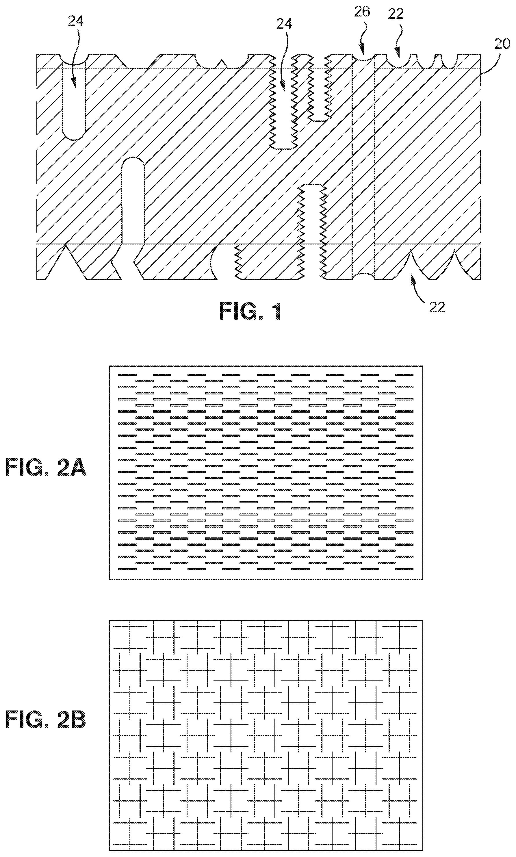 Patent US12496179 Figure 1 – Method and apparatus for creating a modified tissue graft