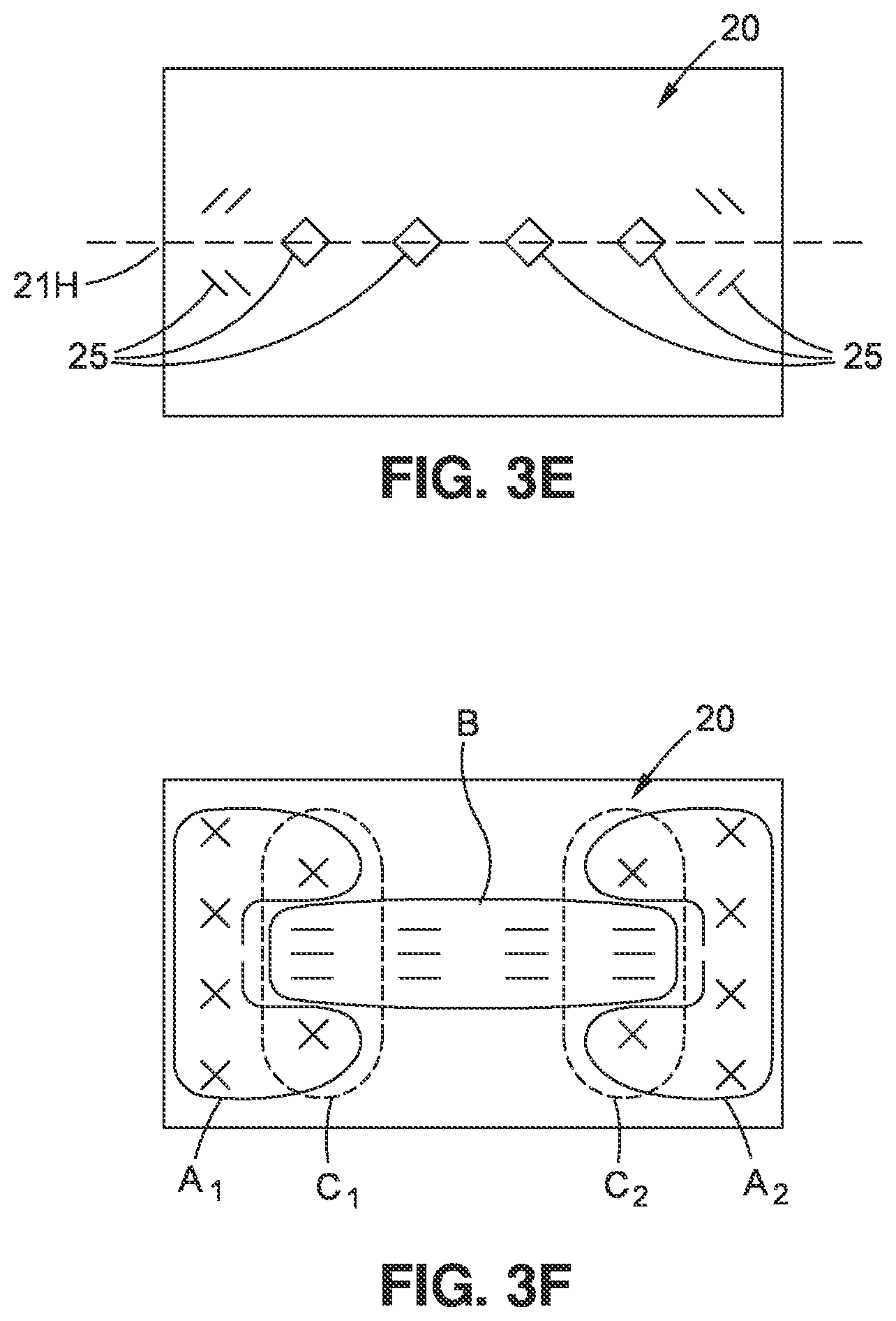 Patent US12496179 Figure 3 – Method and apparatus for creating a modified tissue graft