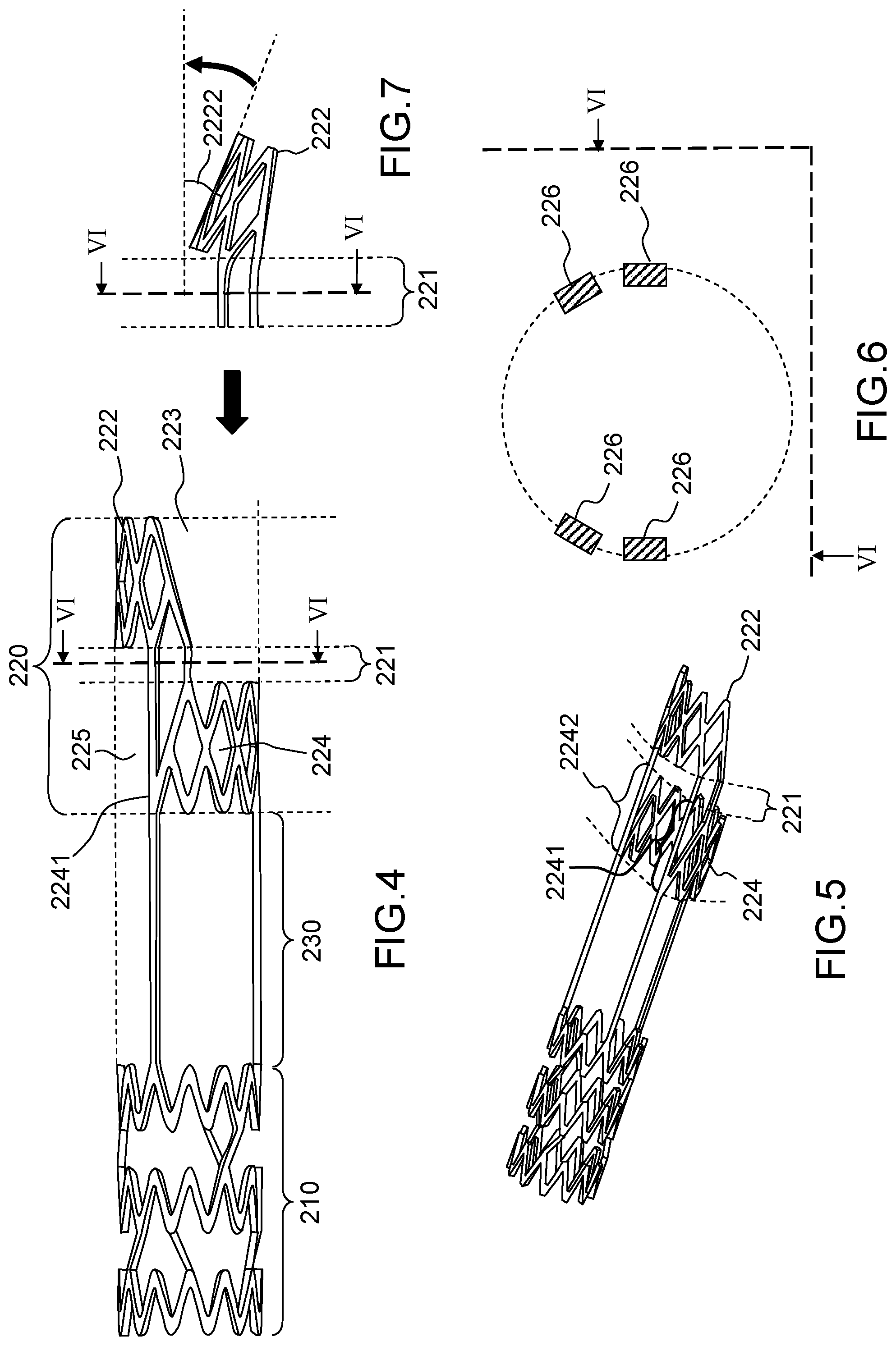 Patent US12496180 Figure 2 – Vascular prosthesis