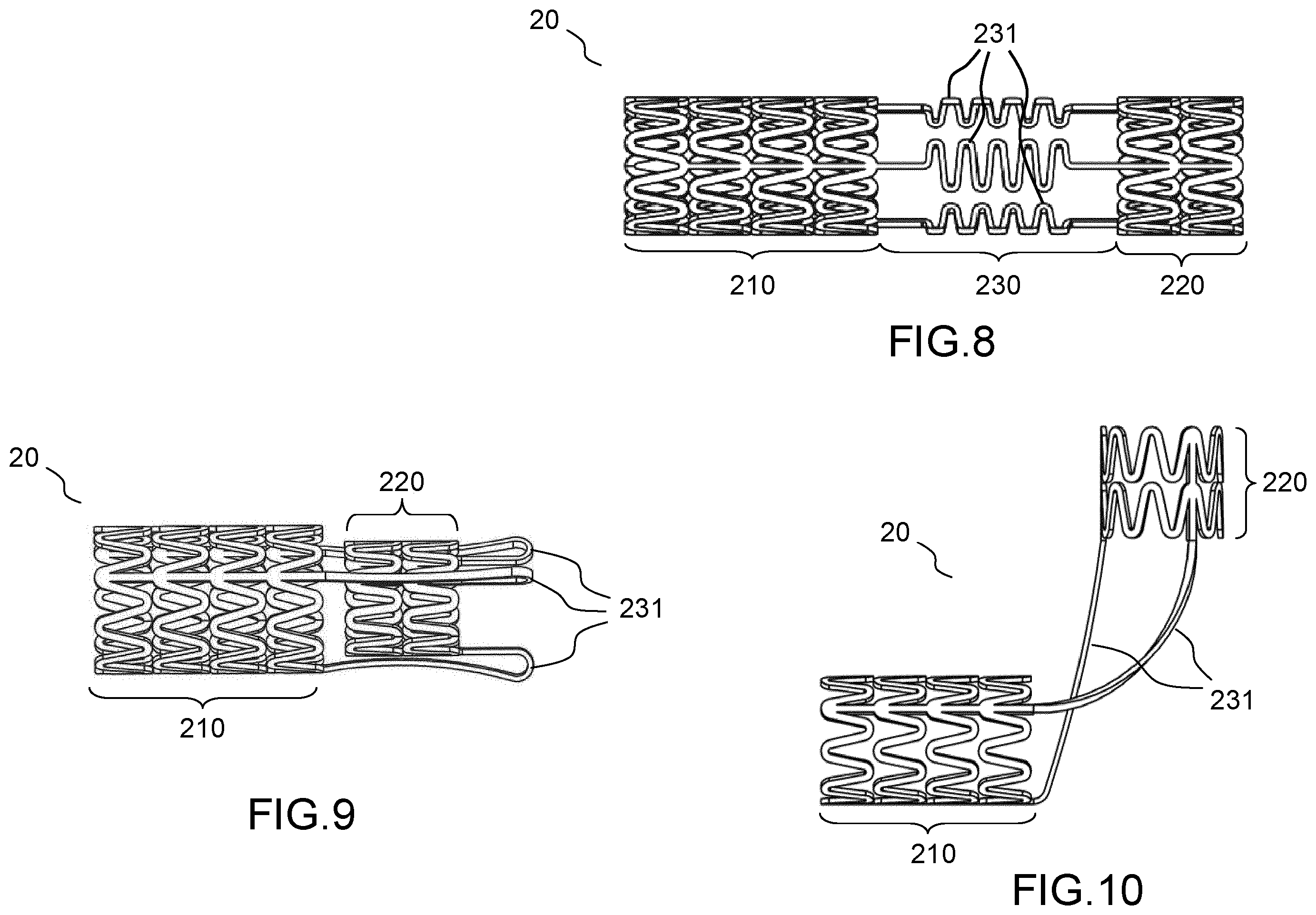 Patent US12496180 Figure 3 – Vascular prosthesis