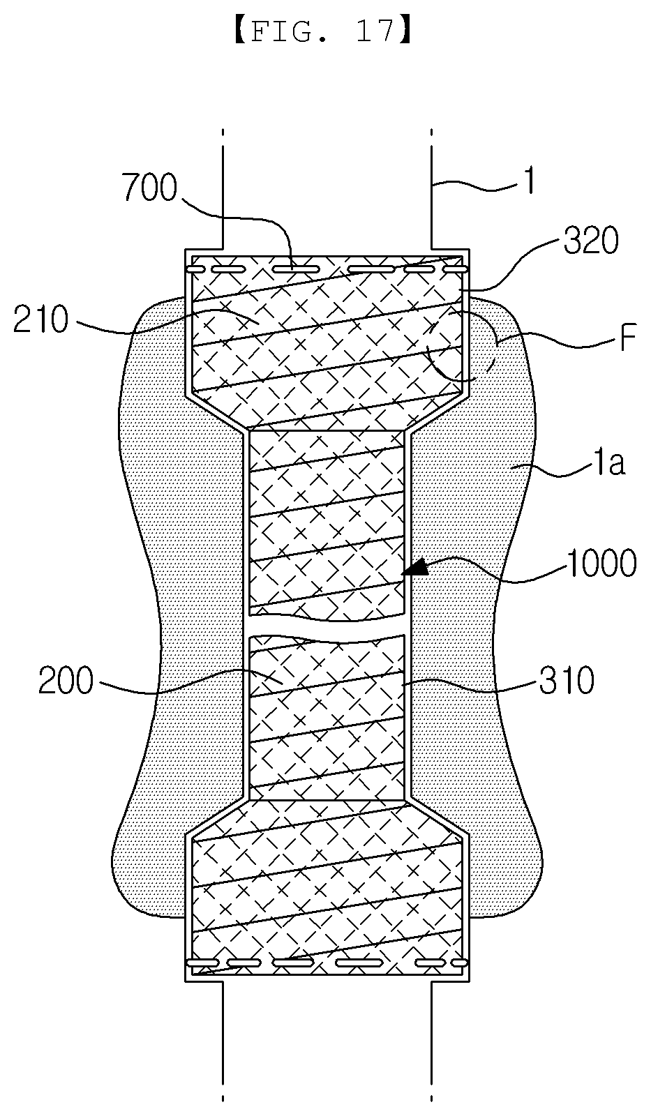Patent US12496181 Figure 12 – Method of manufacturing covered stent and covered stent manufactured thereby