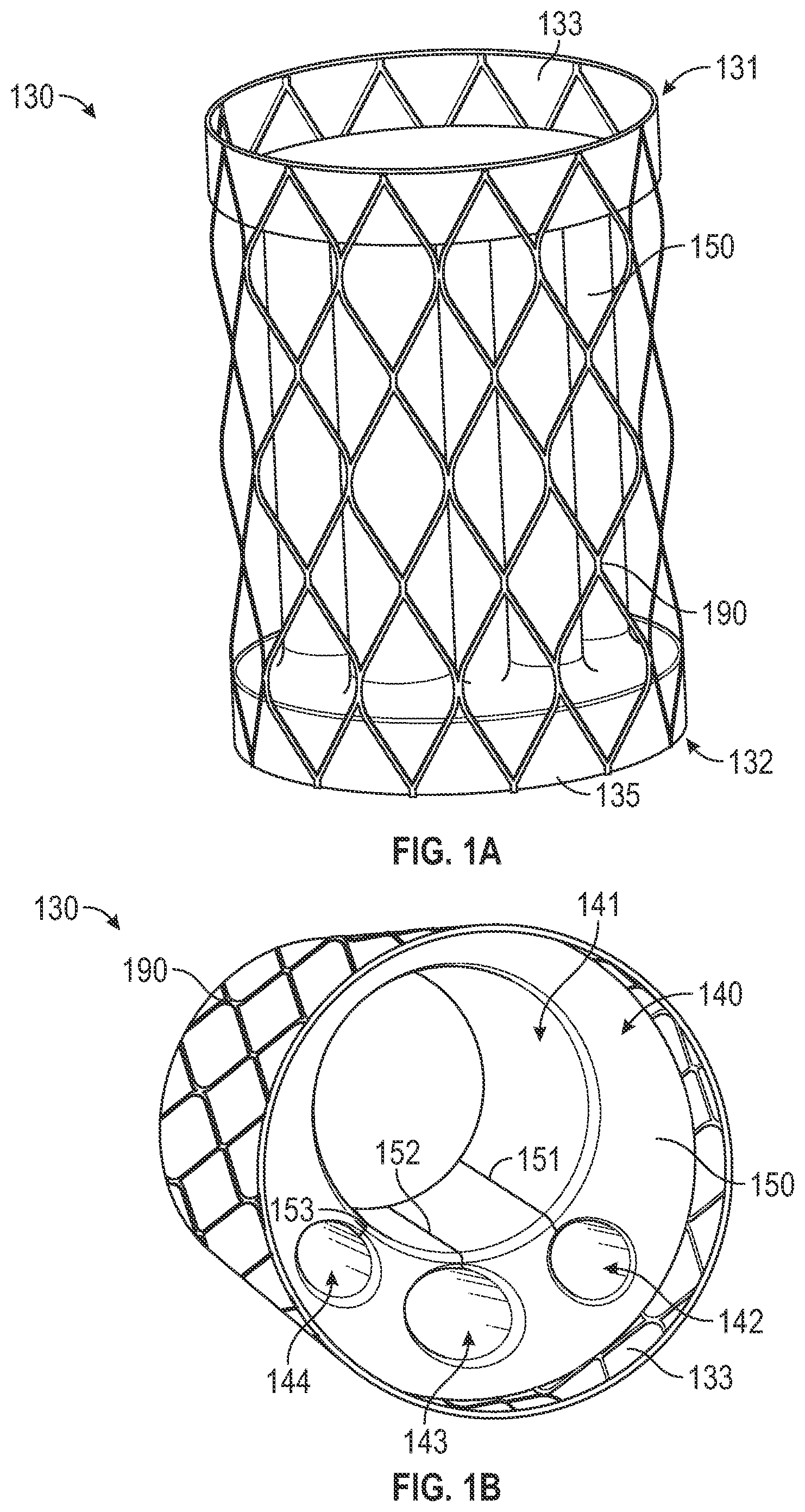 Patent US12496182 Figure 1 – Multi-lumen stent-graft and related surgical methods