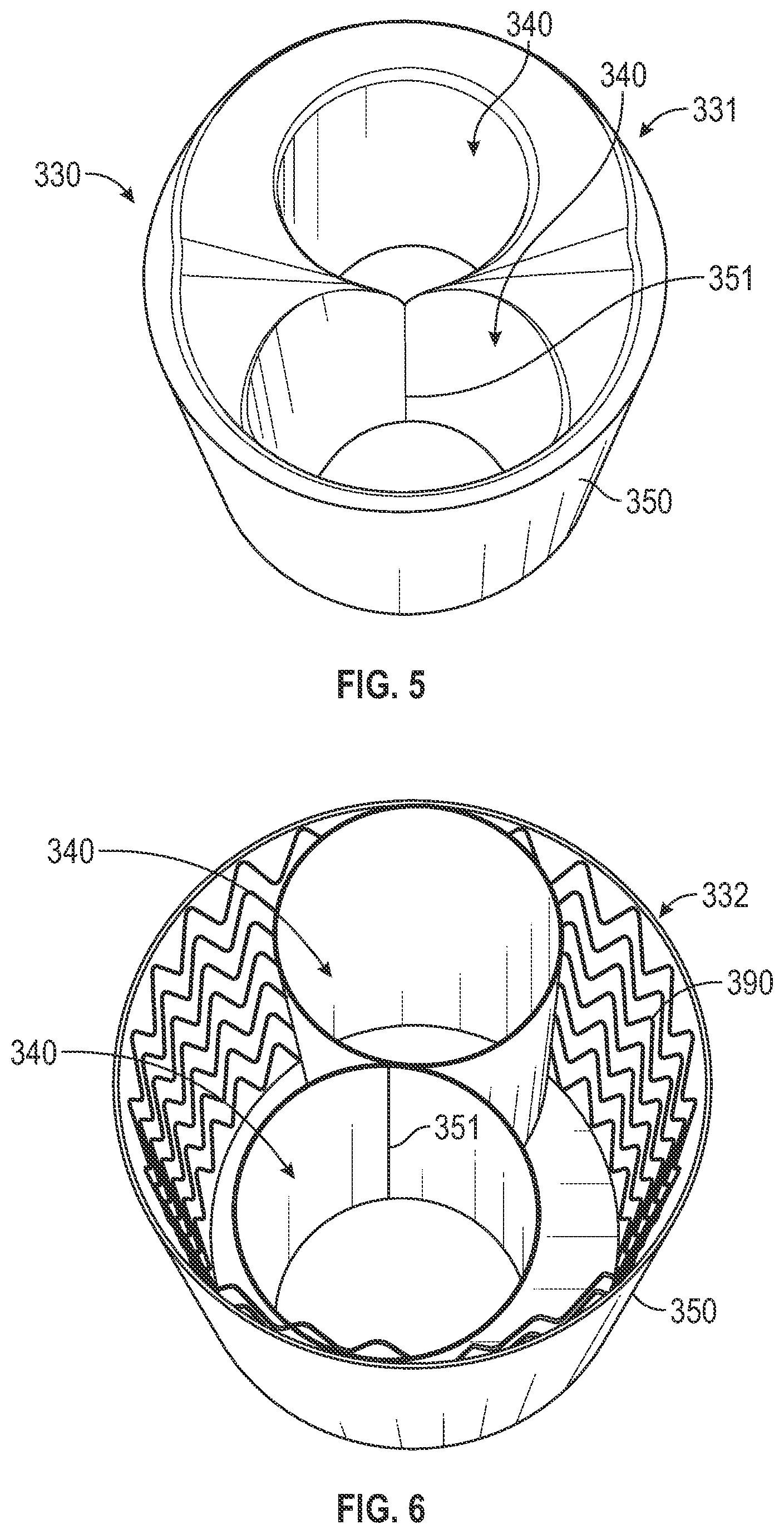 Patent US12496182 Figure 8 – Multi-lumen stent-graft and related surgical methods