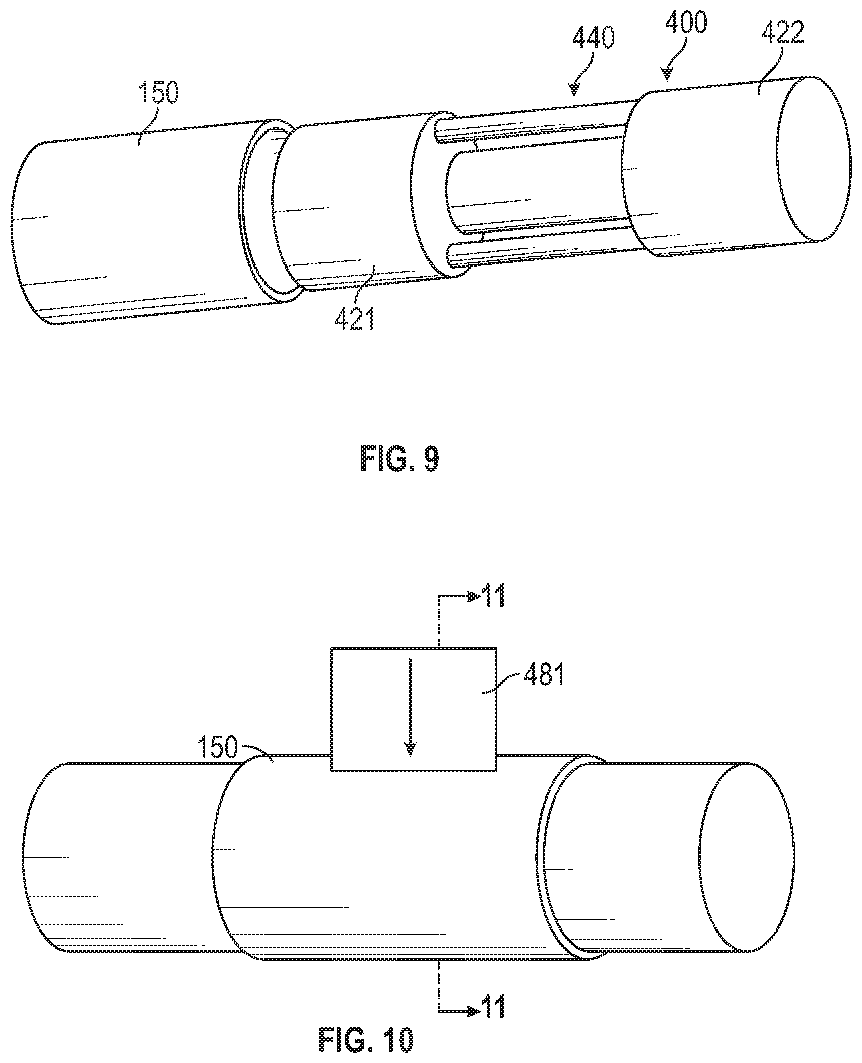 Patent US12496182 Figure 10 – Multi-lumen stent-graft and related surgical methods