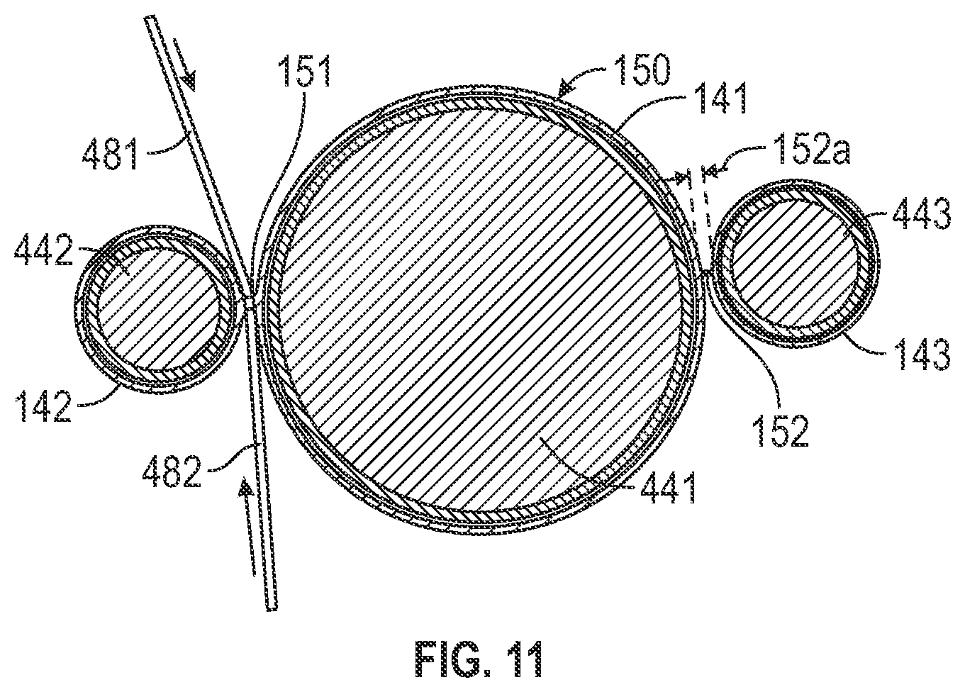 Patent US12496182 Figure 11 – Multi-lumen stent-graft and related surgical methods