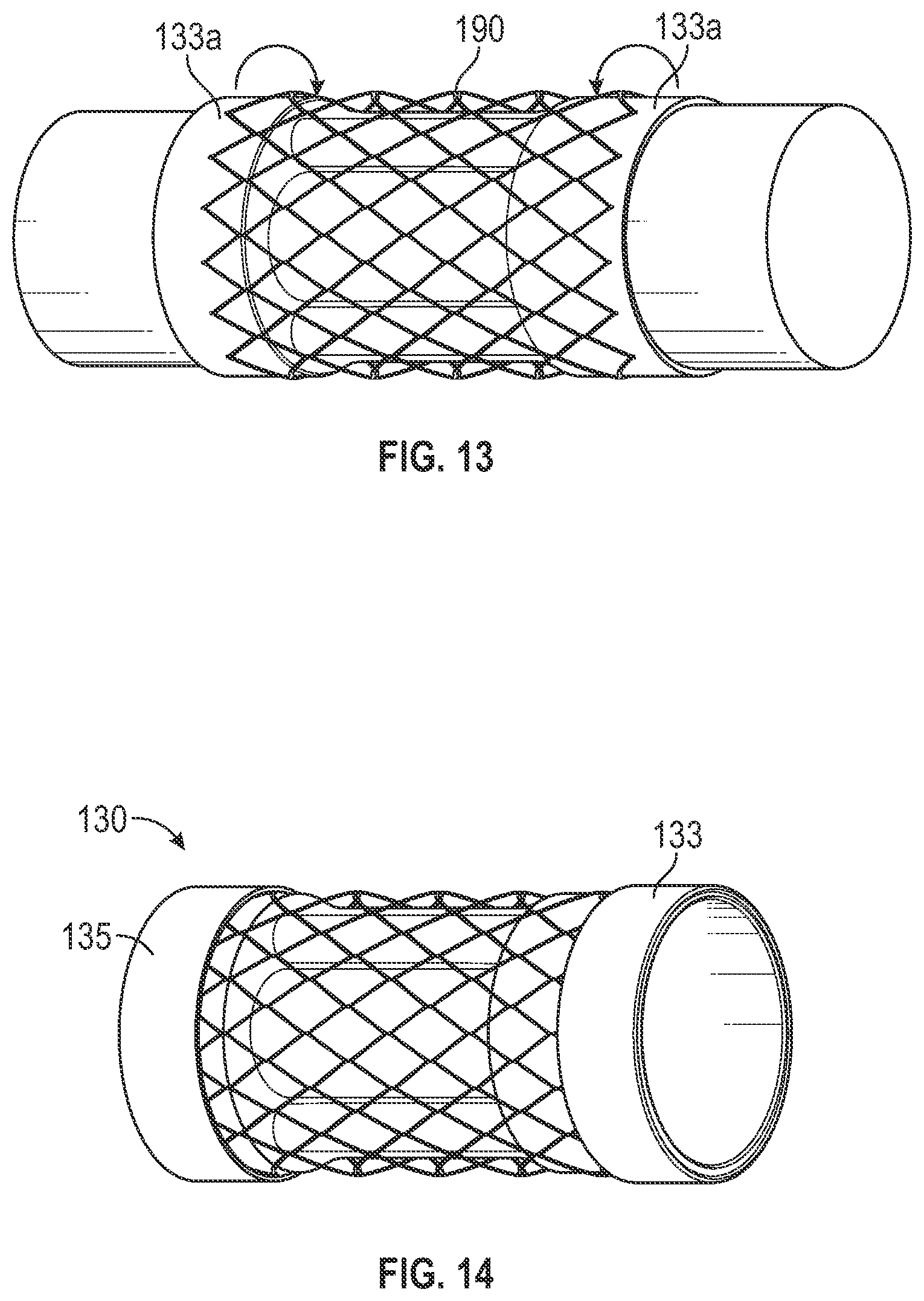 Patent US12496182 Figure 13 – Multi-lumen stent-graft and related surgical methods