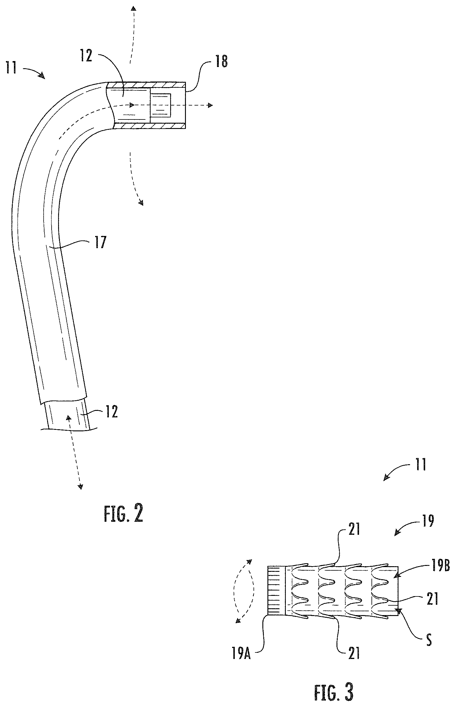 Patent US12496183 Figure 2 – System, method and treatment of aneurysms utilizing endographs