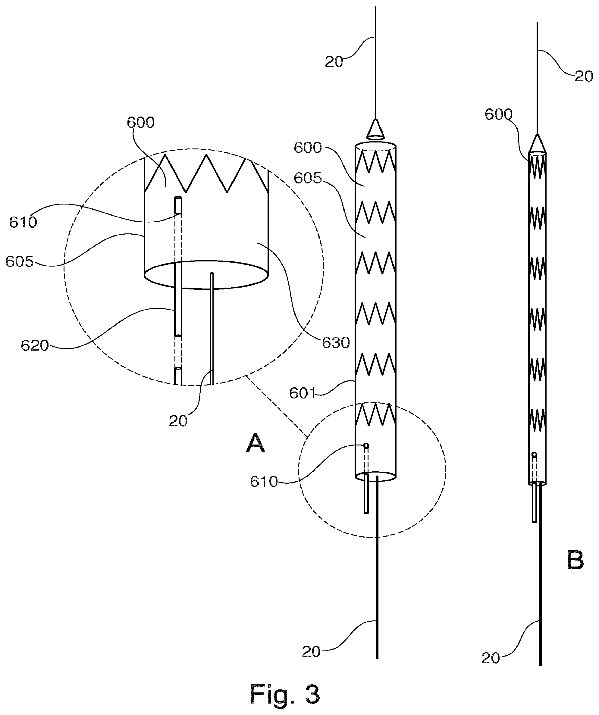 Patent US12496184 Figure 2 – Stent-graft prosthesis, system and method for improved delivery of a stent-graft prosthesis