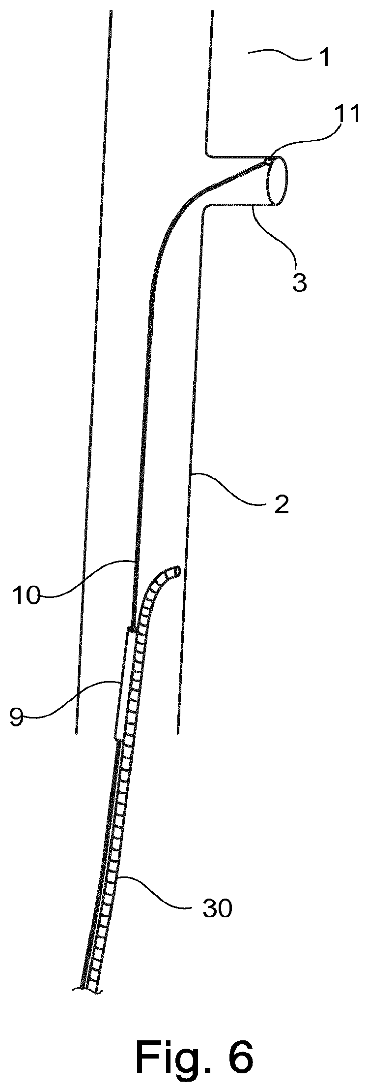 Patent US12496184 Figure 4 – Stent-graft prosthesis, system and method for improved delivery of a stent-graft prosthesis