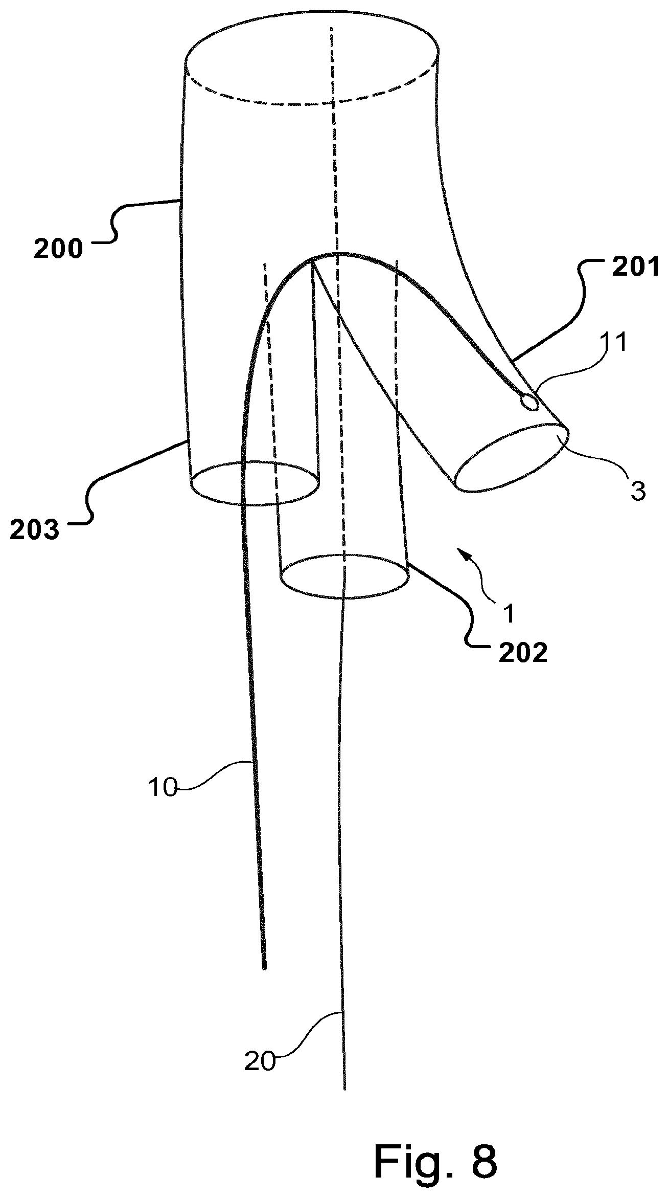 Patent US12496184 Figure 6 – Stent-graft prosthesis, system and method for improved delivery of a stent-graft prosthesis