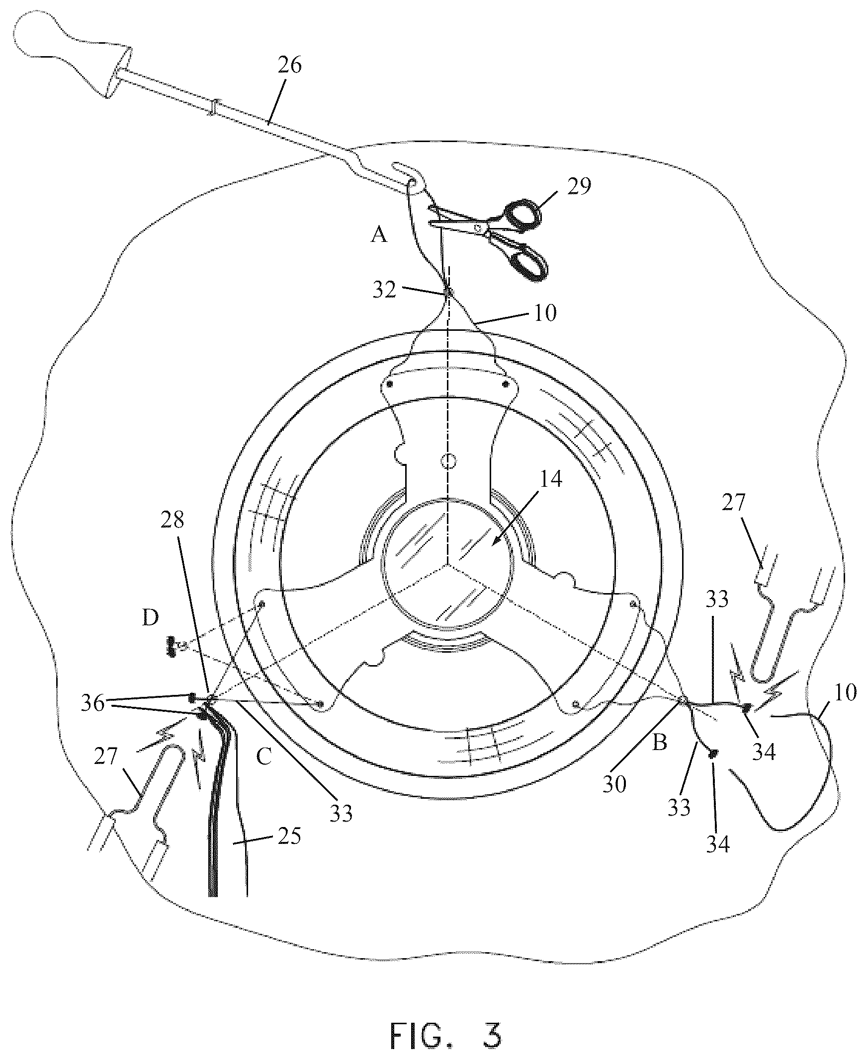 Patent US12496186 Figure 4 – Secondary haptic loops for fixation of intraocular device