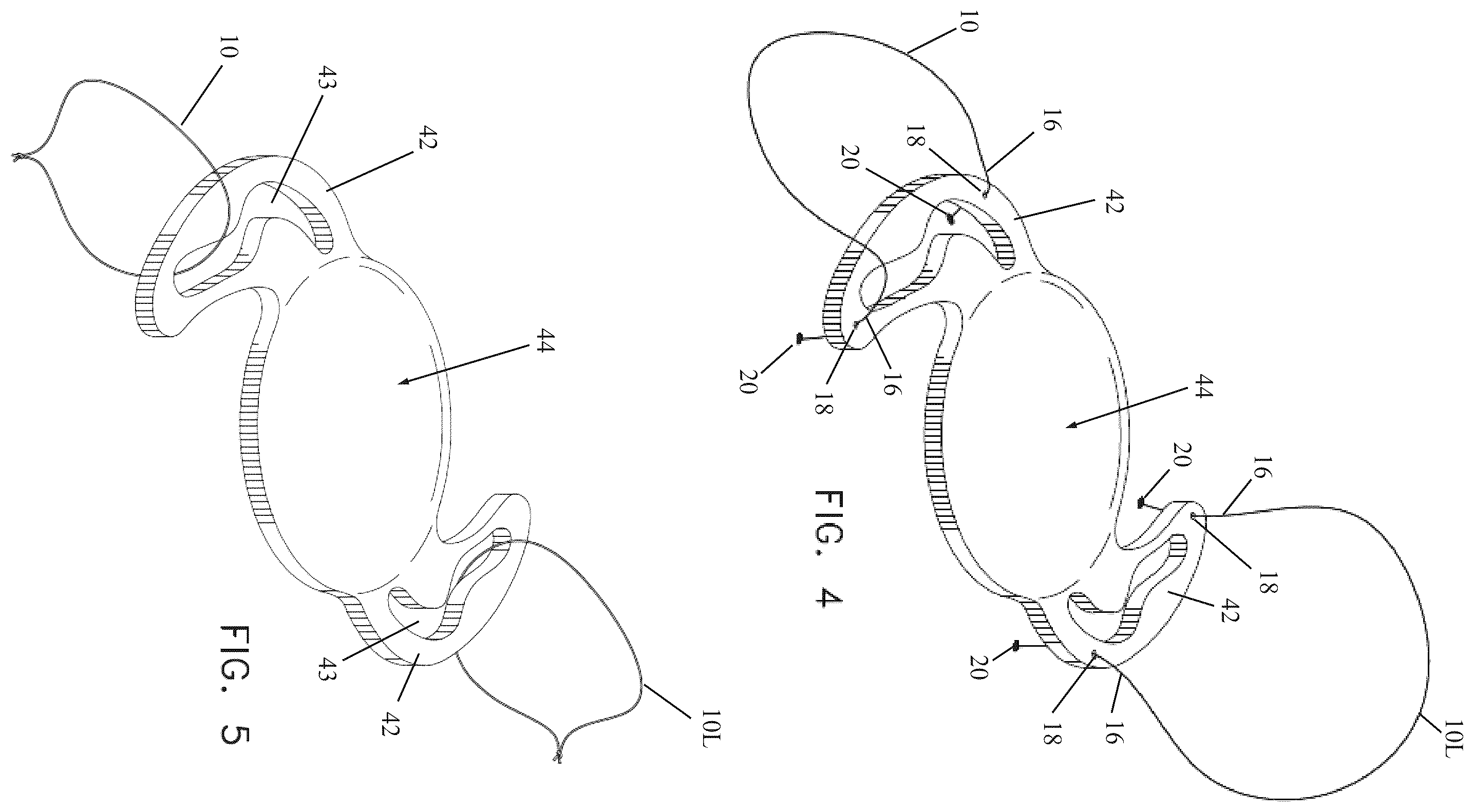 Patent US12496186 Figure 5 – Secondary haptic loops for fixation of intraocular device