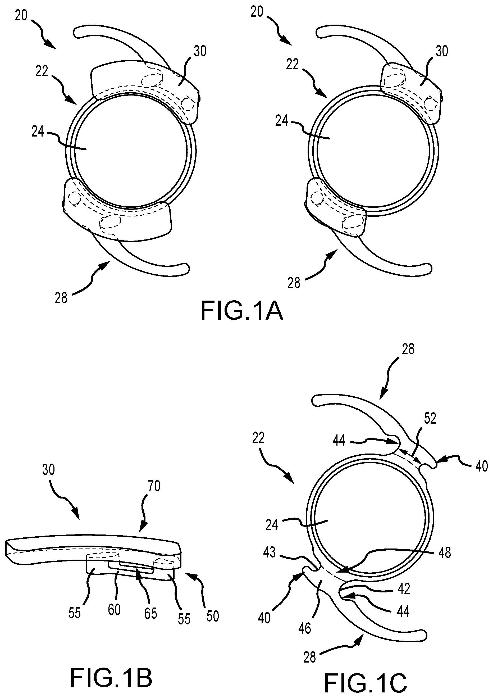 Patent US12496187 Figure 1 – Systems to affix devices to intraocular lens assemblies and related methods