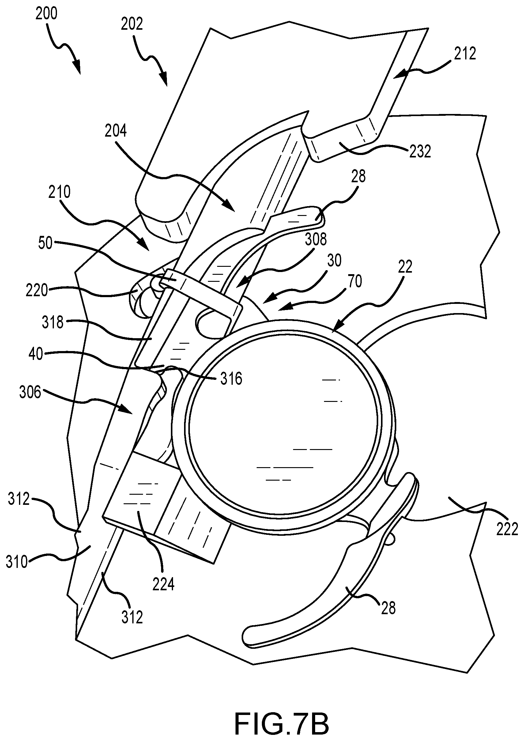 Patent US12496187 Figure 11 – Systems to affix devices to intraocular lens assemblies and related methods