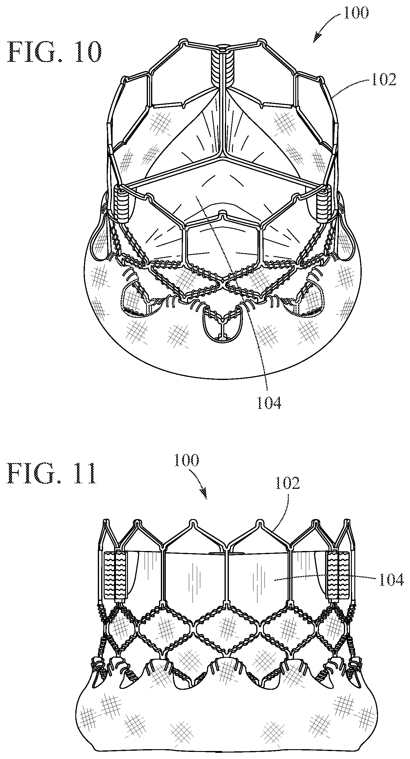 Patent US12496190 Figure 7 – Delivery system for prosthetic heart valve