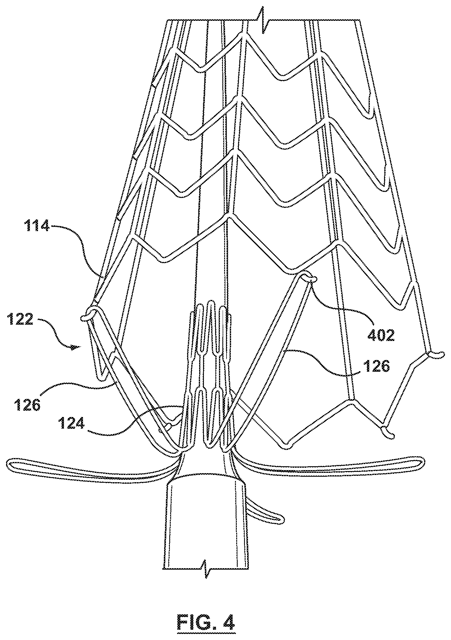 Patent US12496191 Figure 8 – Transcatheter delivery system and method with controlled expansion and contraction of prosthetic heart valve