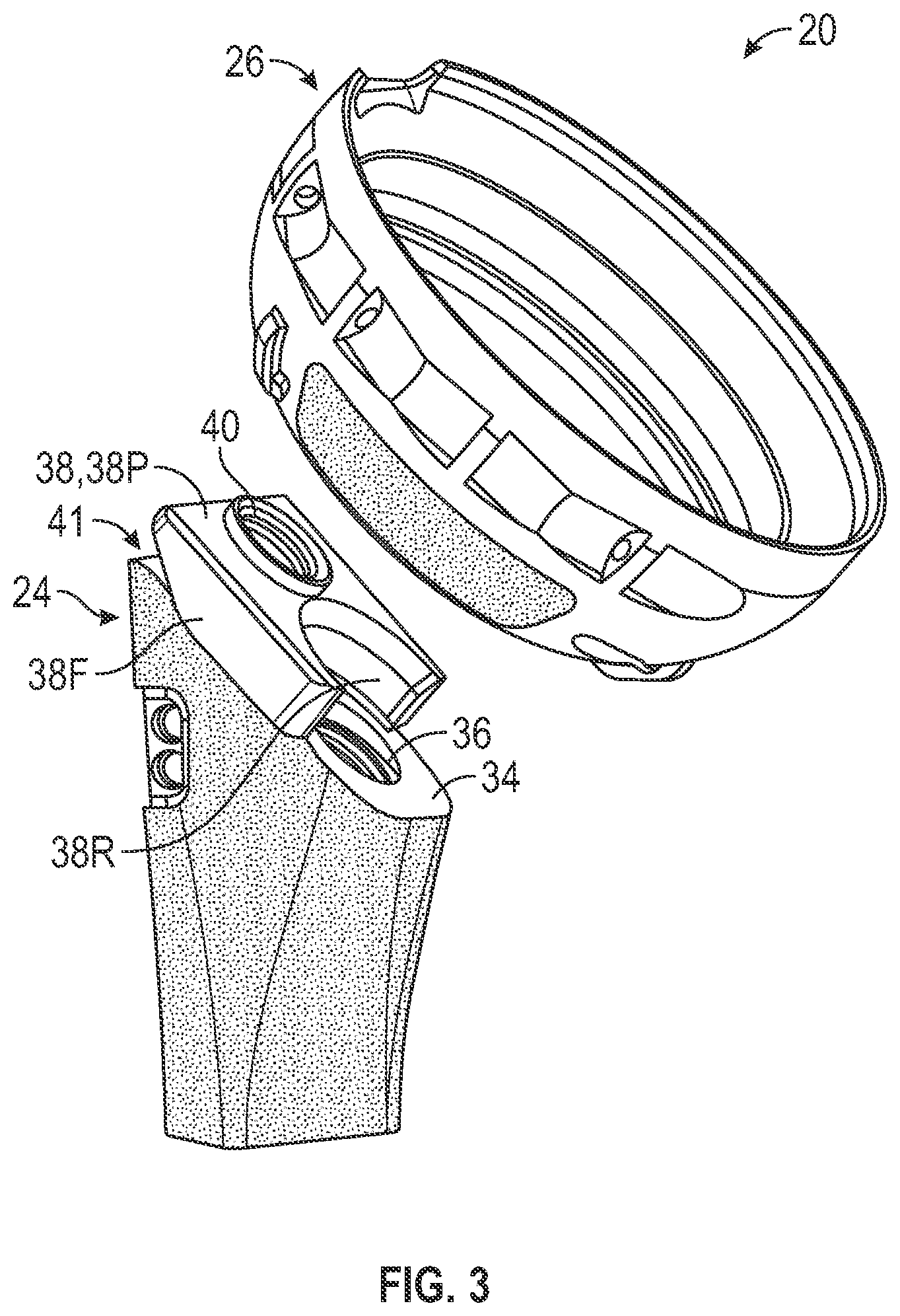 Patent US12496192 Figure 2 – Hydraulic taper separator for orthopaedic implant systems and methods of disassembly